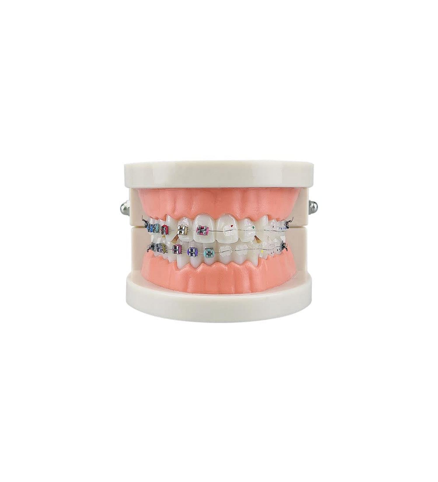 Standard Orthodontic Teeth Model - YOUYA DENTAL Demonstration Tool with Metal & Ceramic Bracket | Ideal for Teaching & Study - Buy Online on GoSupps.com