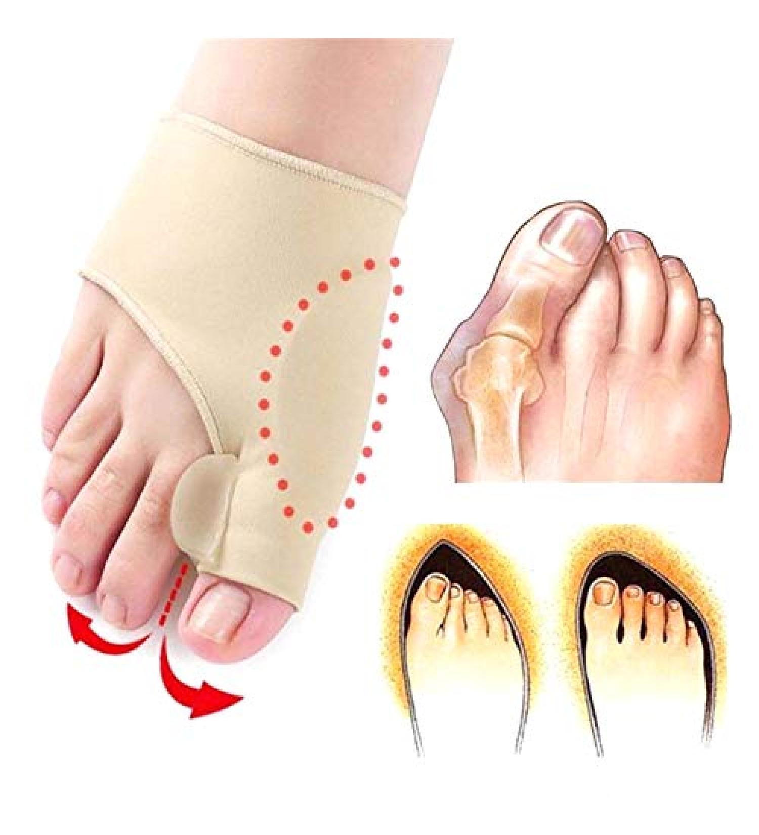 Buy Bunion Corrector - Orthopedic Gel Pads & Toe Separator for Hallux Valgus Relief | Unisex | 1 Pair (Skin - Buy Online on GoSupps.com