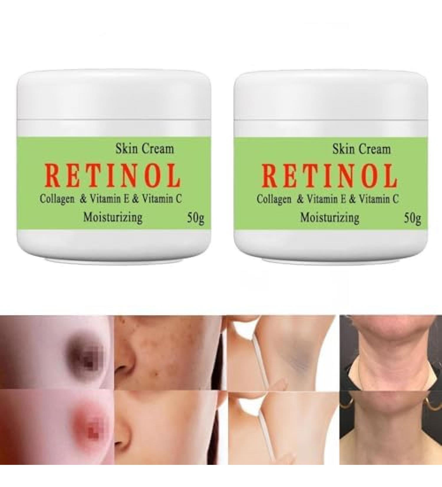 BEROZA Cremas Para Las Manchas de La Cara 50g Cremas para quitar manchas de la cara Vitamin C&E Face Moisturizer Cream Crema para manchas oscuras en la piel (2pcs) - Buy Online on GoSupps.com