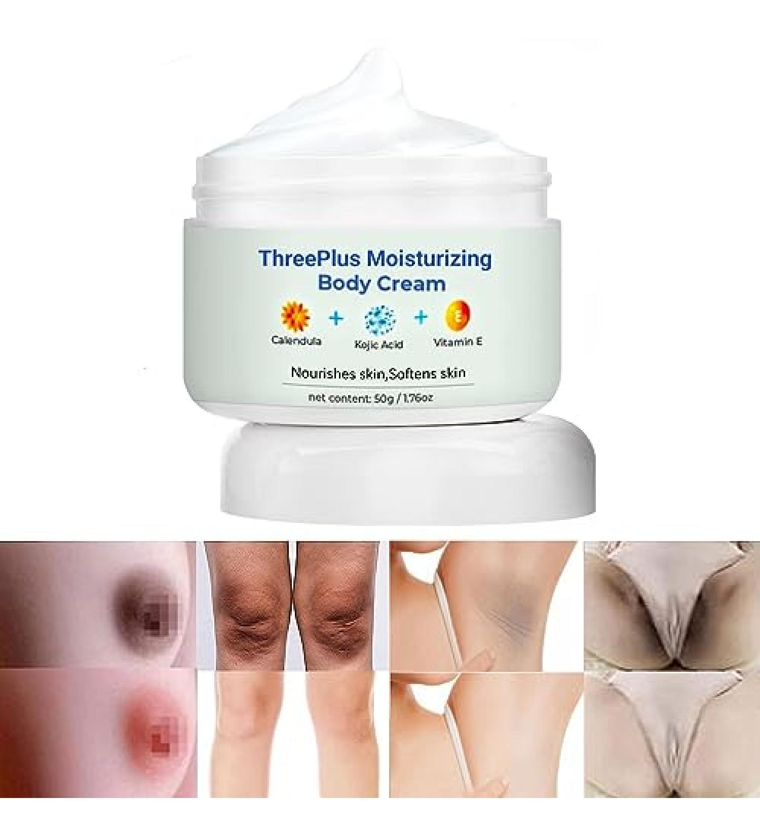 BEROZA Cremas Para Las Manchas de La Corporales 50G Para Piel Entrepierna Manchas Codos Piernas Zonas ntimas Cara Axilas Rodillas Cuello 50G - Buy Online on GoSupps.com