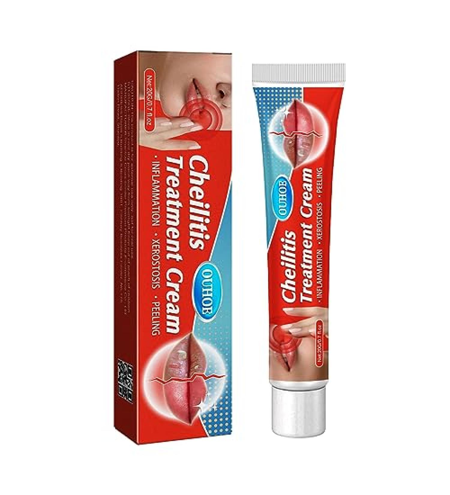 Healing Lip Balm for Dry Cracked Lips | Natural & Organic Cheilitis Treatment for Men Women & Children | Dermatologist Recommended All-Day Moisture - Buy Online on GoSupps.com