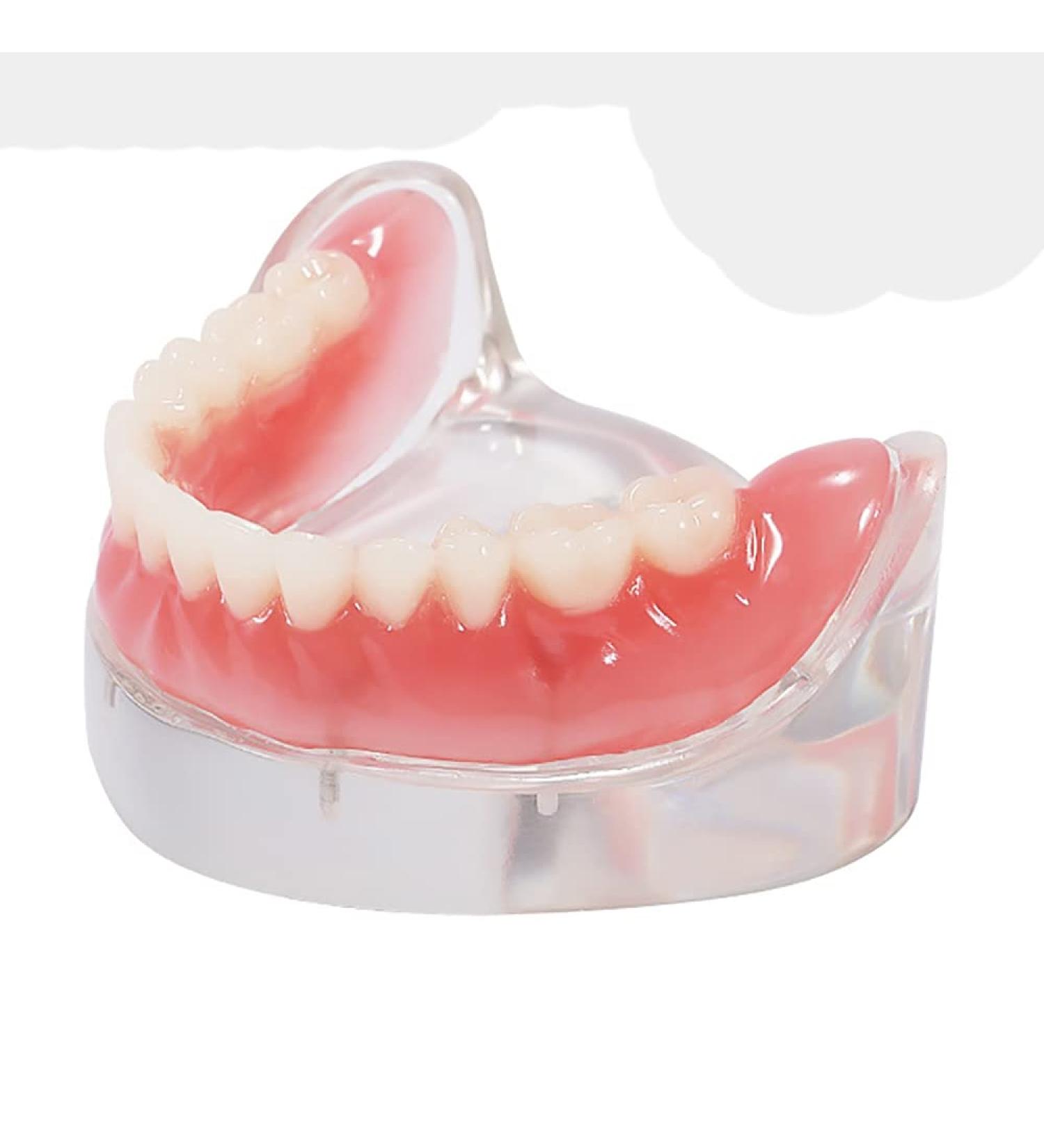 COMDS Dental Implant Model & Removable Dentures for Educational Use | 4 Nail Implant Demo Models - Buy Online on GoSupps.com