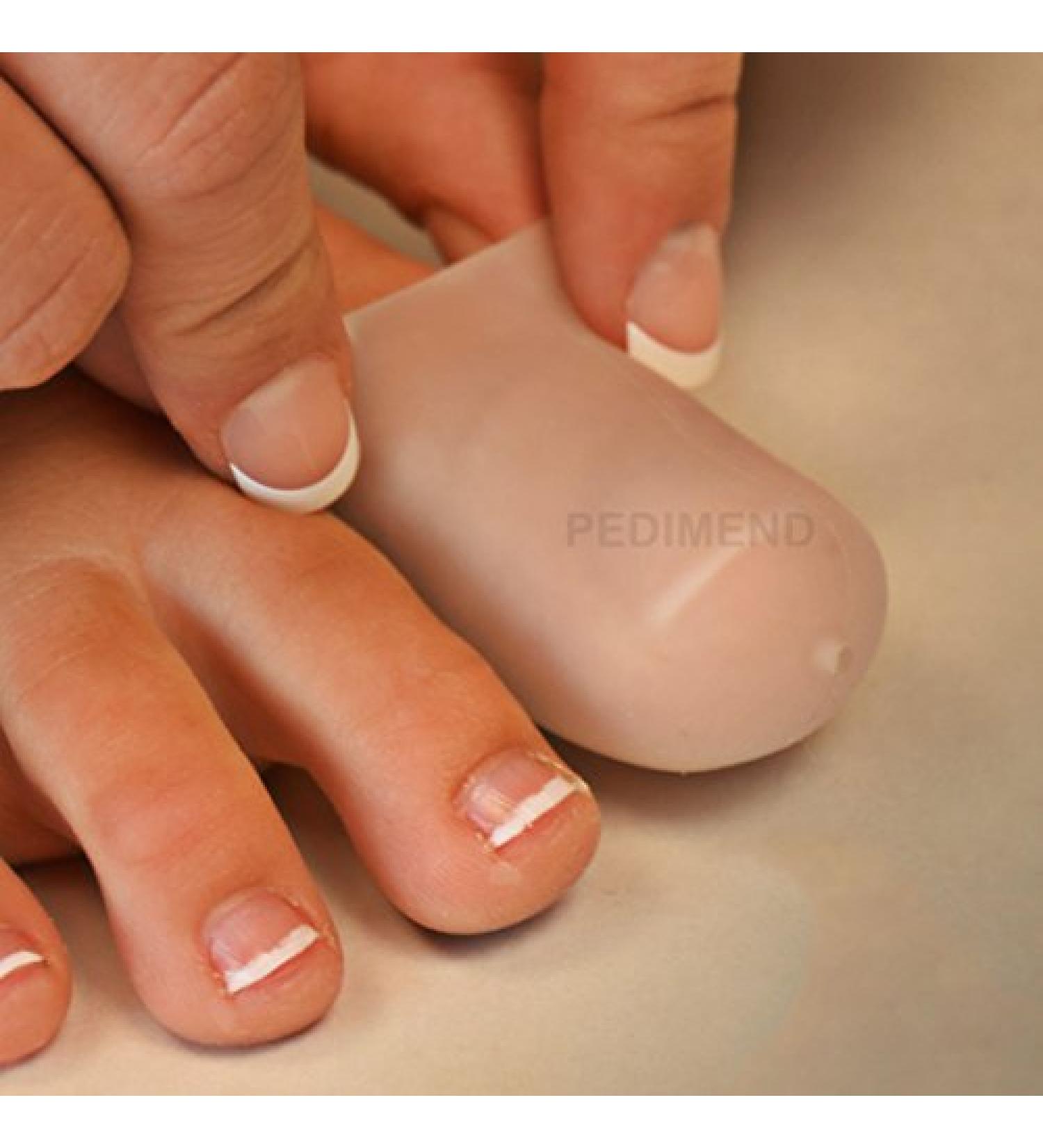 PediMend Big Toe Silicone Protector Sleeves for Blisters, Corns, Ingrown Toenails - Pain Relief for Men & Women - 1 Pair (White) - Buy Online on GoSupps.com