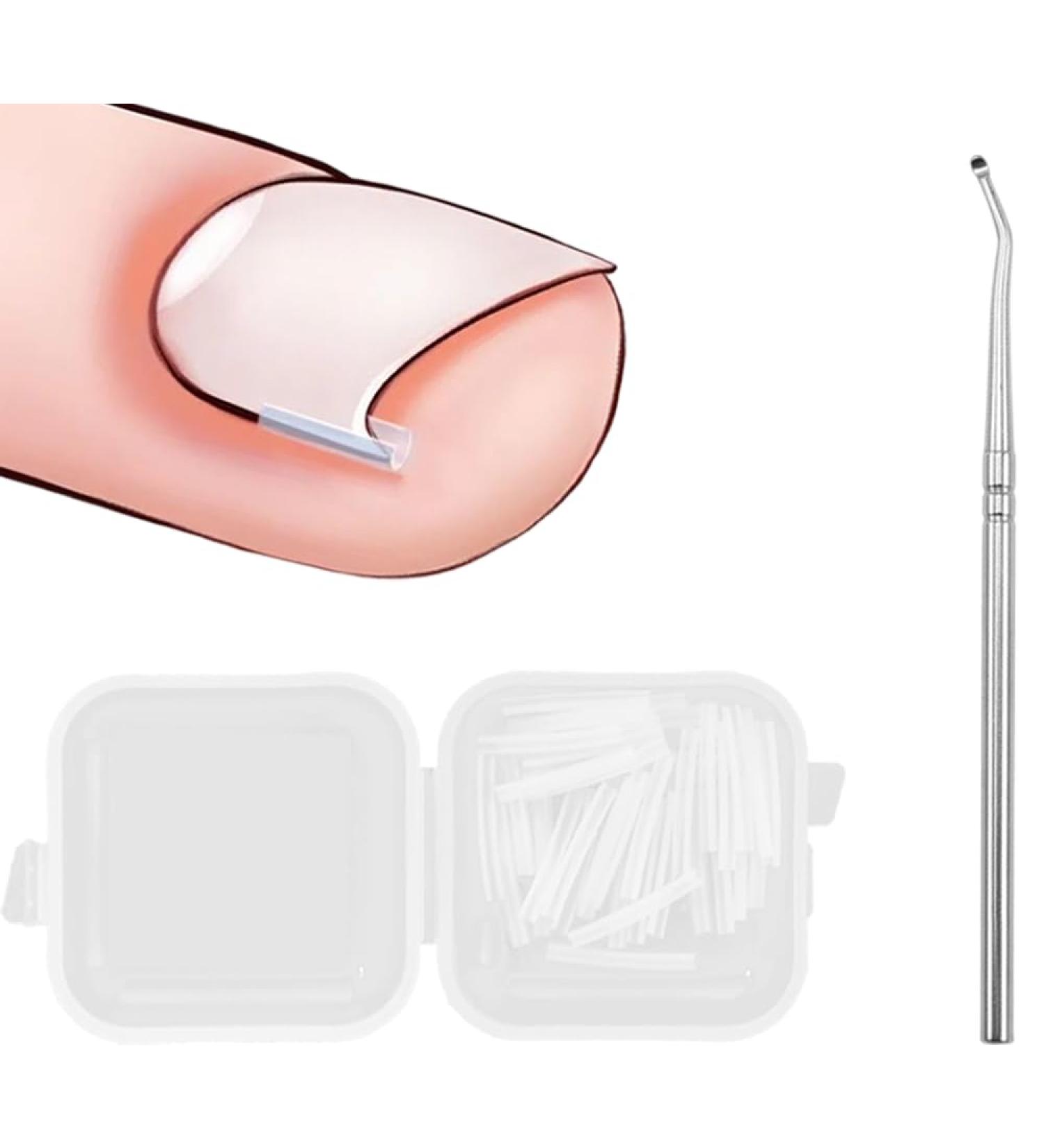 KINDOYO Correction Ingrown Toenails Set - 40 Pieces Painless Toenail Smoothing Strips with Toenail Lifter - Simple Tool Set for Ingrown Toenails - Buy Online on GoSupps.com