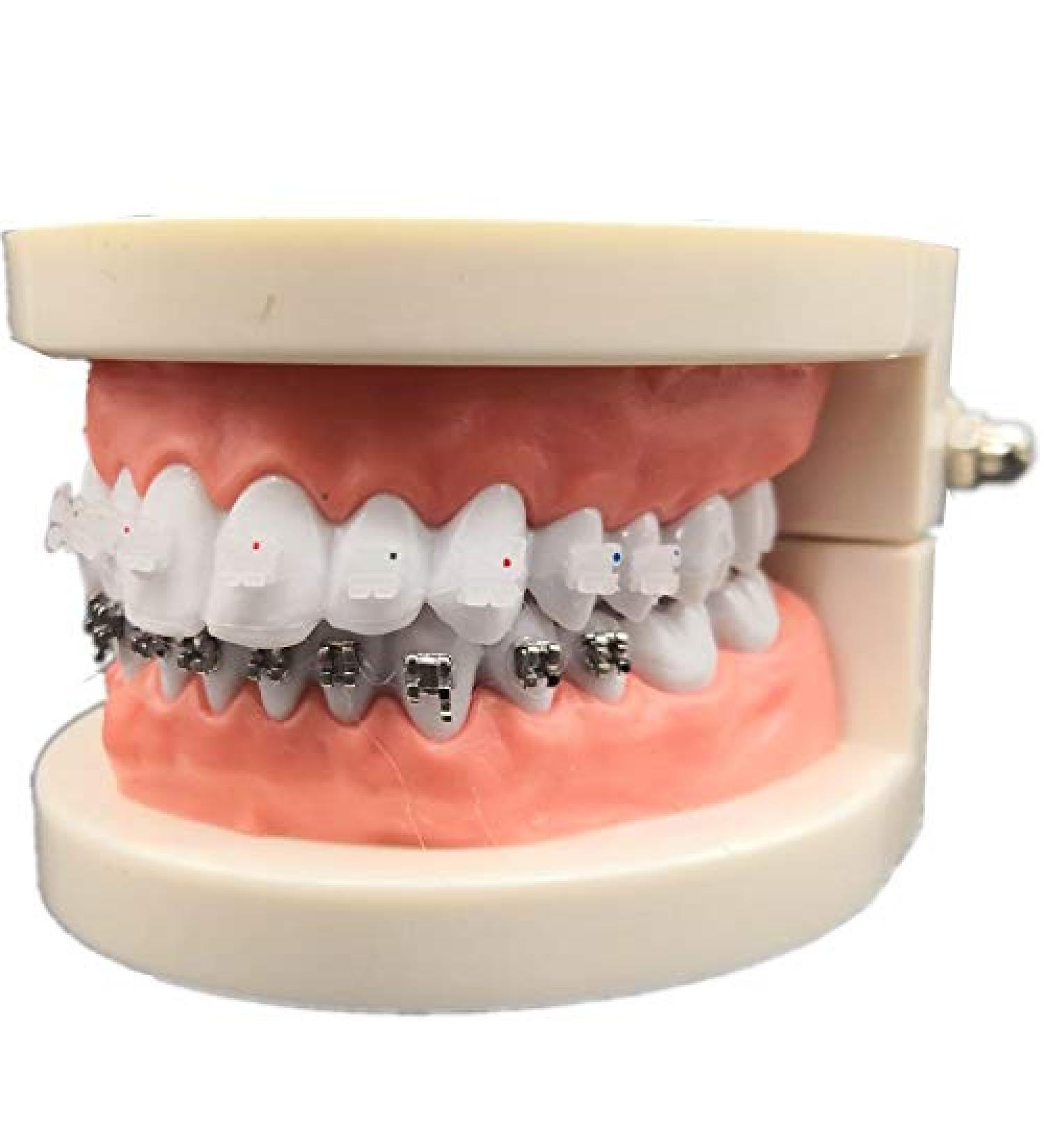 Dental Orthodontic Treatment Model with Ortho Metal Ceramic Bracket Arch Wire Buccal Tube Ligature Ties