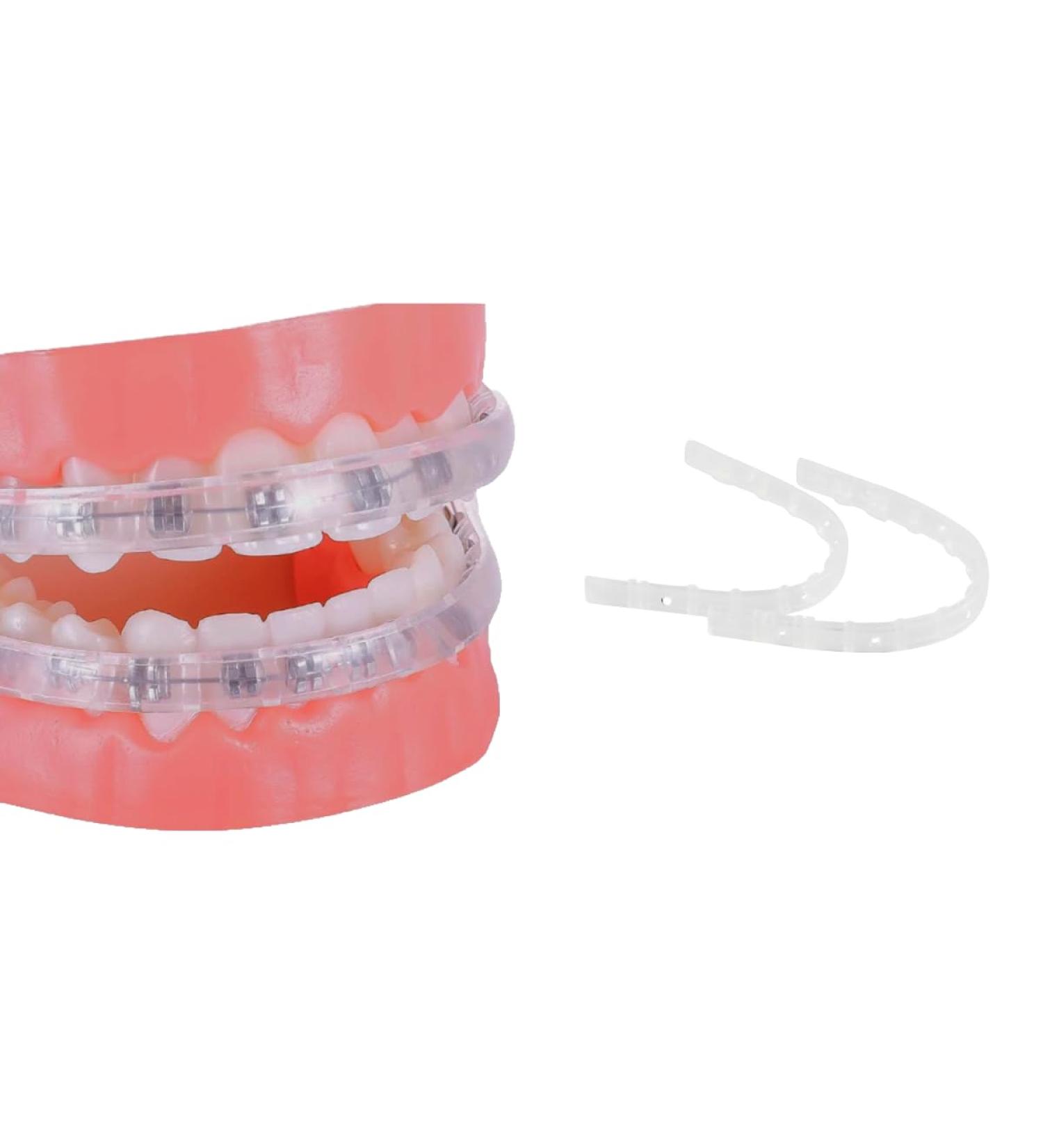 Buy DeltaDent Mouthguard for Braces - Replace Orthodontic Wax & Enhance Comfort with Lip Pads - Best Solution for Orthodontics - Buy Online on GoSupps.com