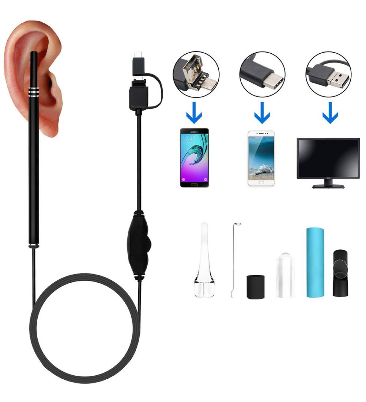 Buy iSpchen Digital Otoscope 3 in 1 - Portable Ear Camera & Earwax Removal Kit for Effective Earwax Cleaning Worldwide Shipping - Buy Online on GoSupps.com