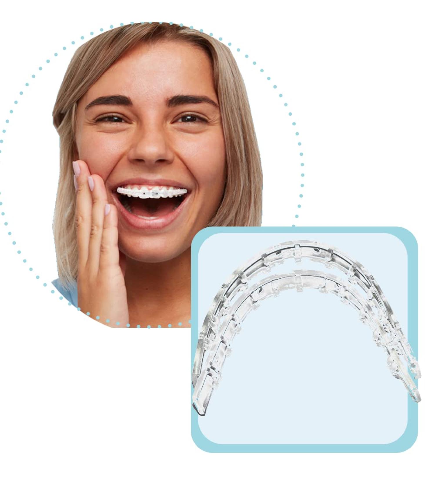 Tecnidentusa Clip-On Comfort Lip Shield - Braces Dental Wax Alternative - Buy Online on GoSupps.com