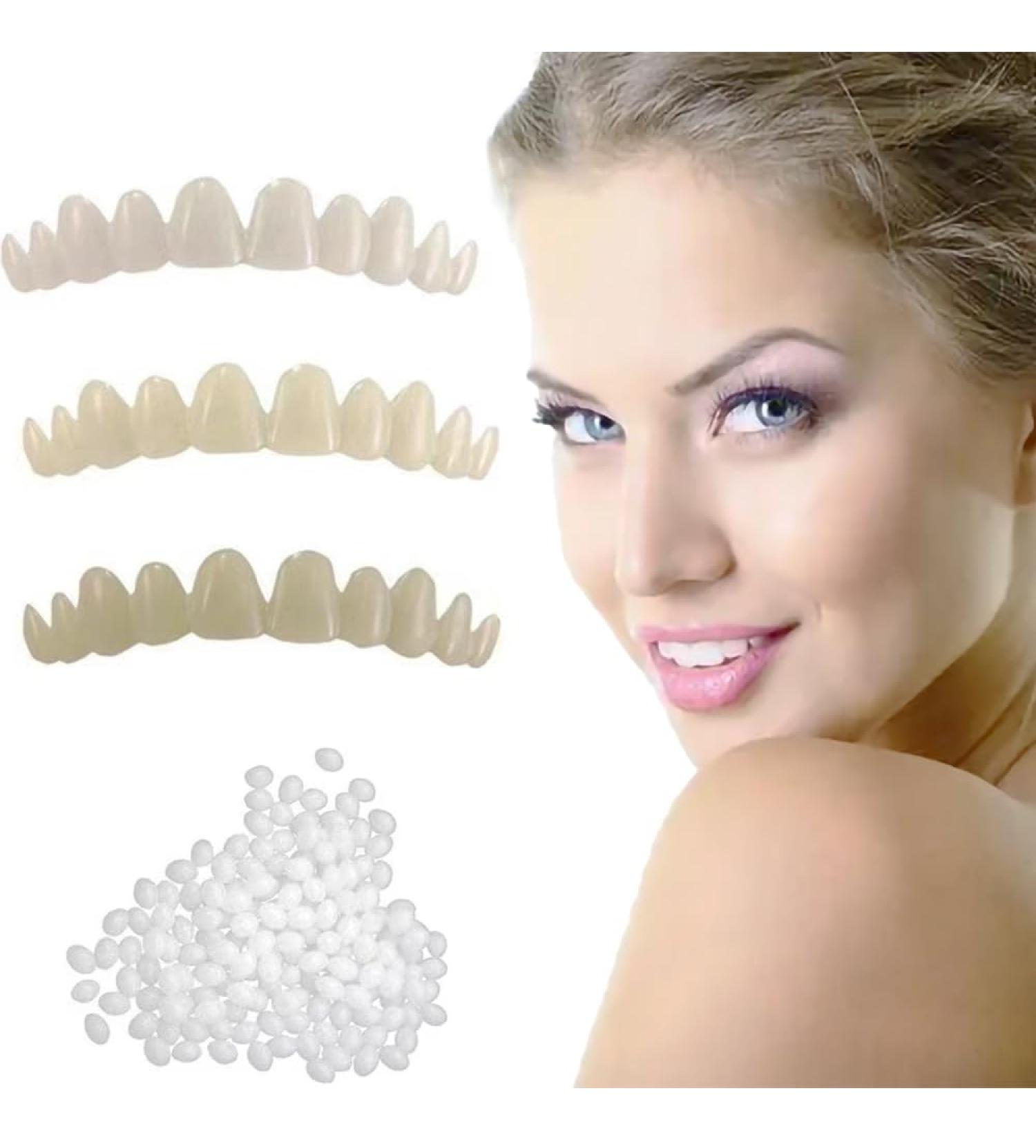 Dental Repair Kit - Quick Fix for Lost & Broken Teeth | Natural-Looking Smile Restoration - Buy Online on GoSupps.com