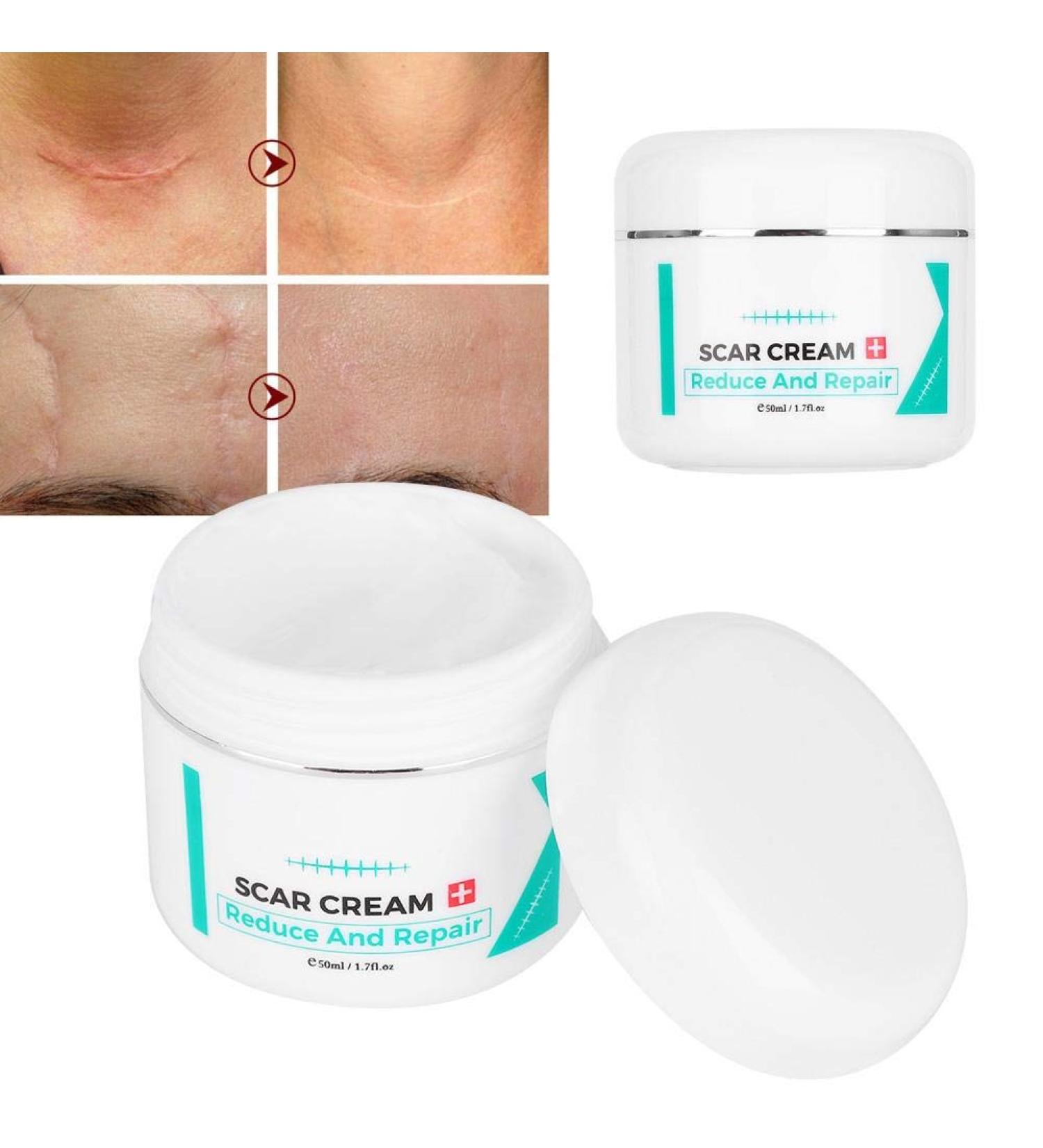 Scar Removal Cream | Stretch Marks Serum | Skin Repair Treatment - Buy Online on GoSupps.com