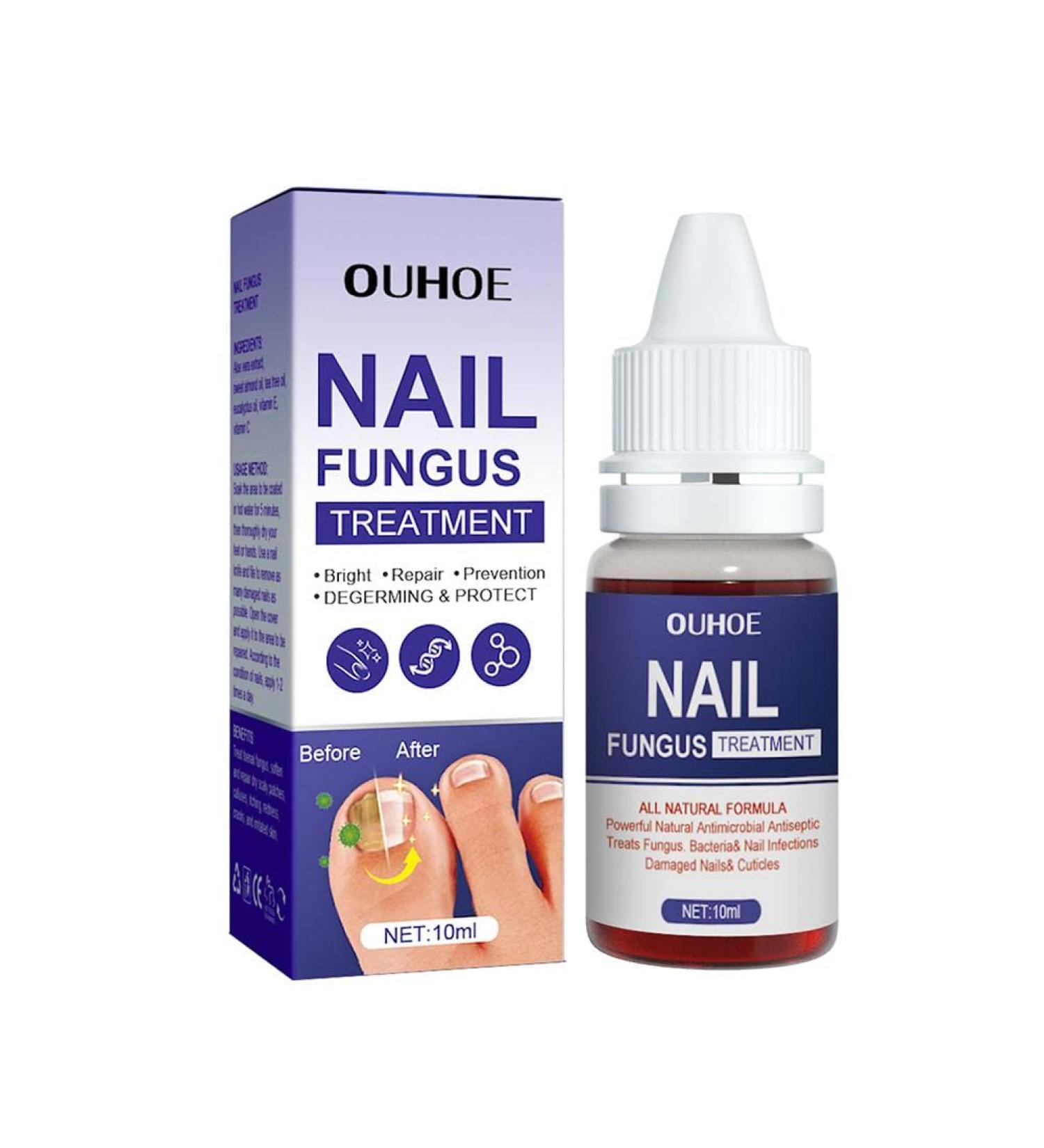 ZERZK 10ml Repair Nail Fungus Treatments Essence Foot Care Nails AntiInfection Toe Fungus Serum Onychomycosis Removal Gel - Buy Online on GoSupps.com