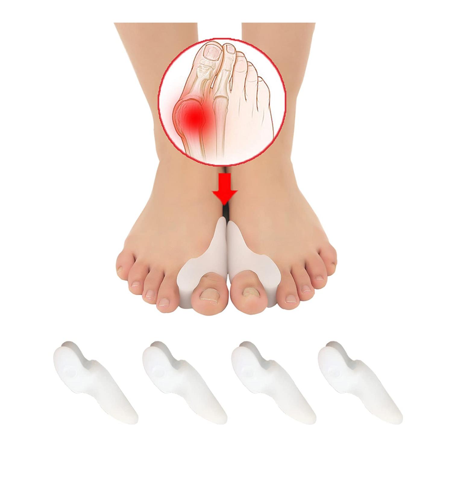 Silicone Toe Separators - 4 PCS Bunion Corrector for Men and Women - Restore Big Toes to Original Size - White 3 - Buy Online on GoSupps.com