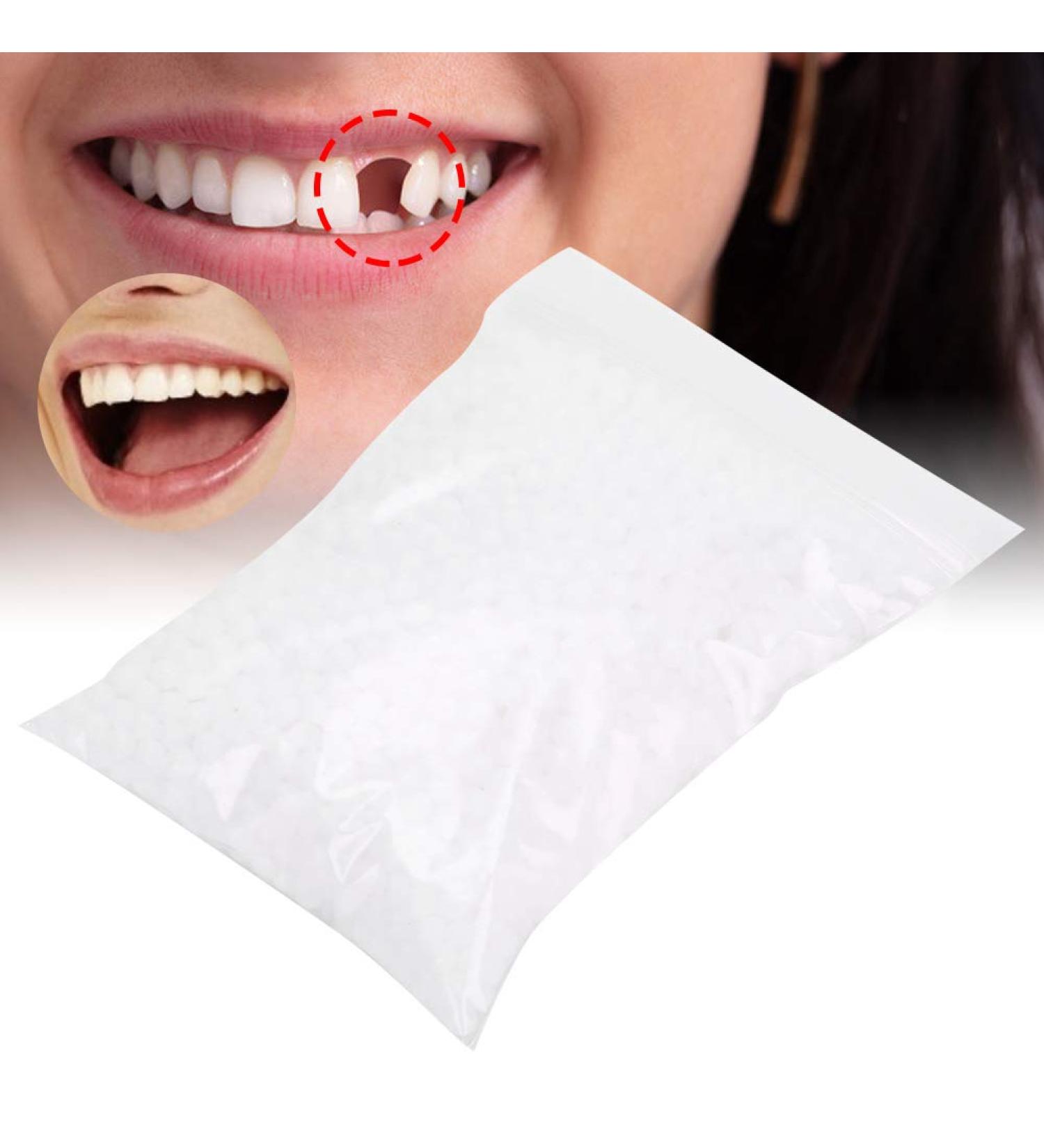 Provisional Teeth Denture Set - Instant Veneers Thermal Adhesive Pearls & Temporary Tooth Repair (50g) - Buy Online on GoSupps.com