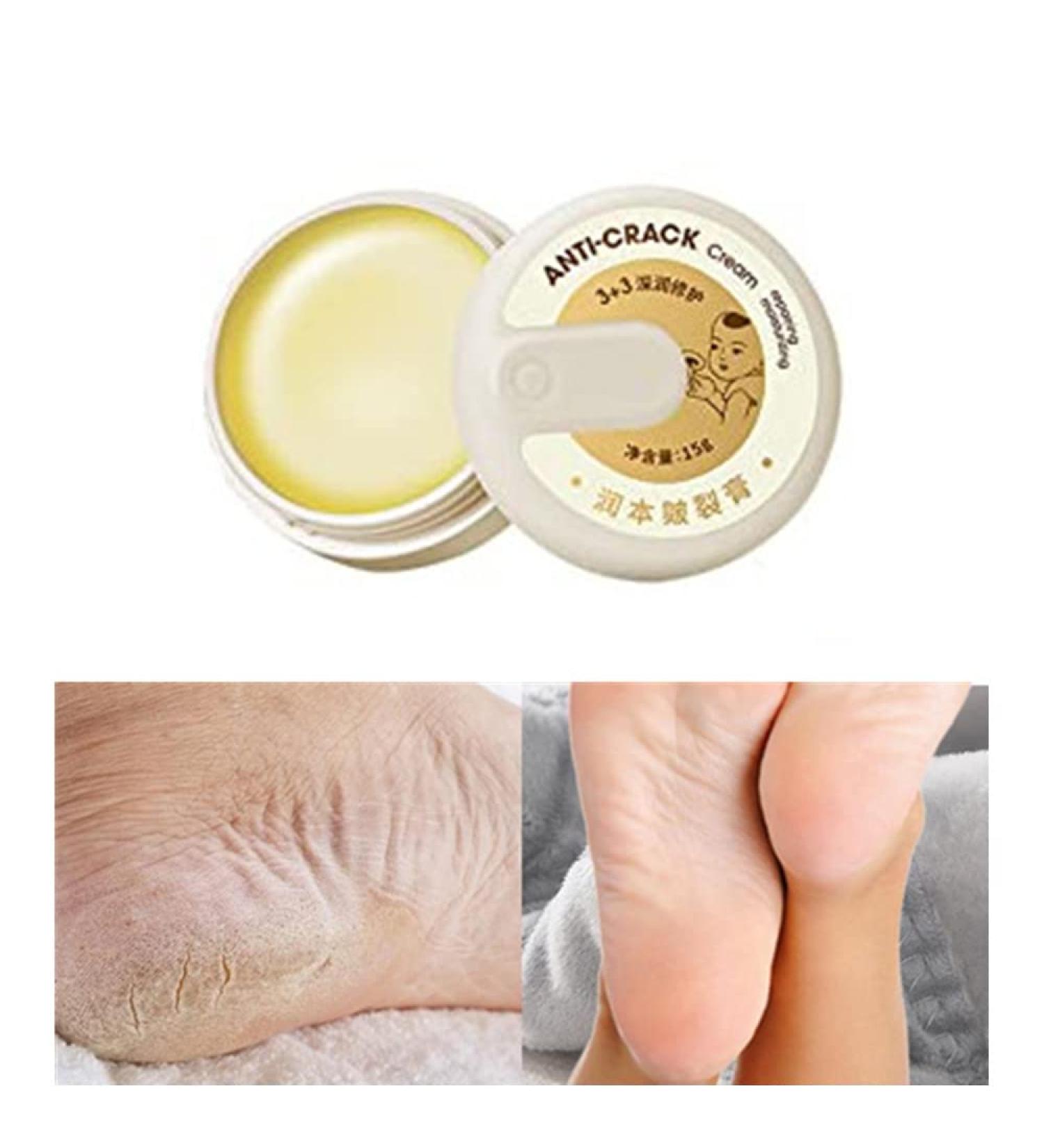 Yutingchby Natural Winter Anti-Cracking Frost - 100% Natural Moisturizing Foot Cream for Rough Dry and Cracked Hands - Buy Online on GoSupps.com