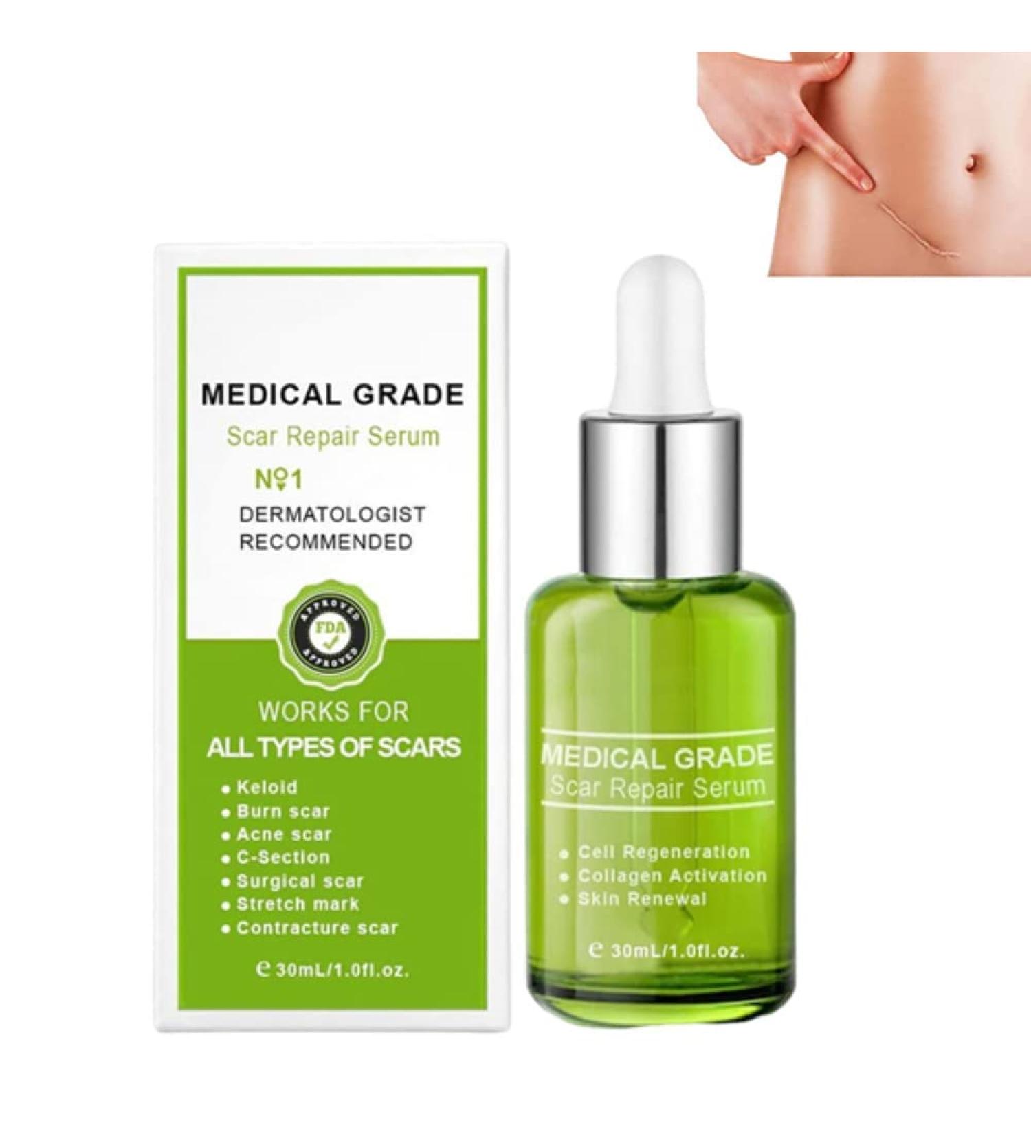 flysmus Advanced Scar Repair Serum - Medical Grade Spray for All Types of Scars (1PCS) - Buy Online on GoSupps.com
