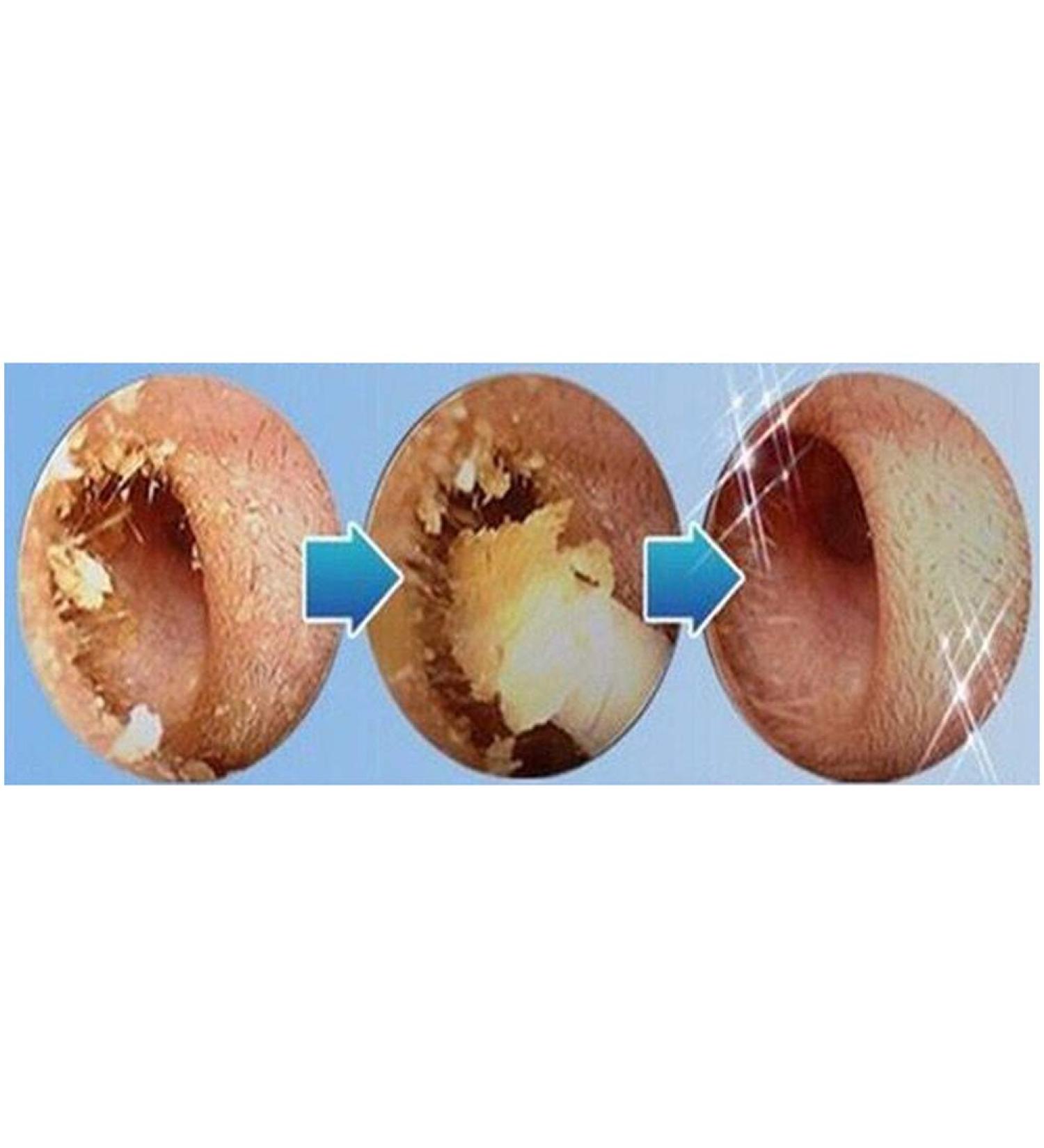 Azusumi Electric Ear Wax Remover - Soft Spiral Cleaner for Painless & Safe Earwax Removal - Buy Online on GoSupps.com