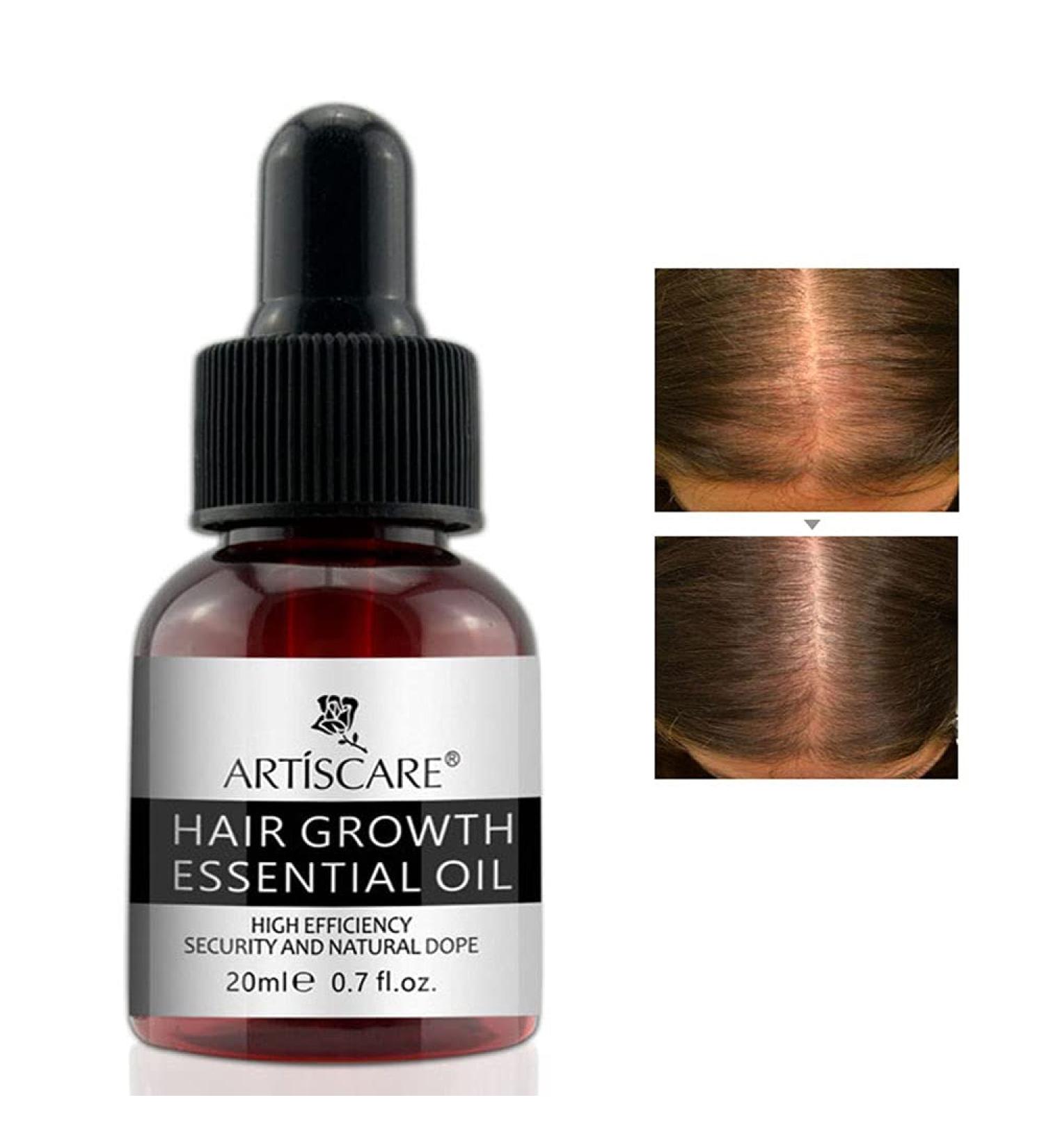 Hair Growth Essential Oil for Men & Women - Regenerate Thinning Hair & Prevent Hair Loss - Powerful Scalp Treatment Serum for Damaged Hair & Thicker Regrowth - Buy Online on GoSupps.com