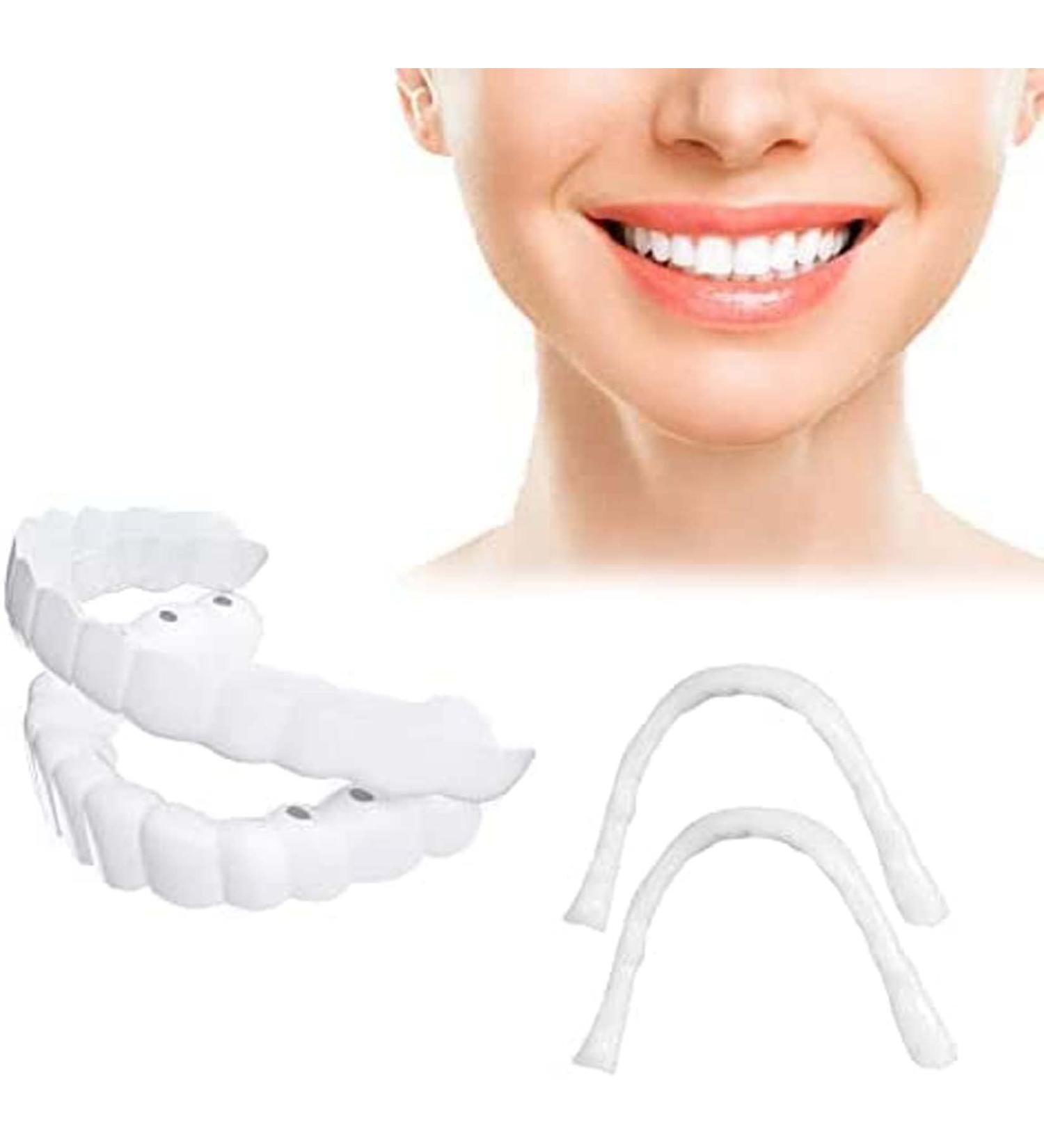 Customizable Temporary Perfect Fake Teeth Molds for Braces Deformities - Cover Chapped Teeth, No Pain or Drilling - Gain Confidence with a Nice Looking Smile - Buy Online on GoSupps.com