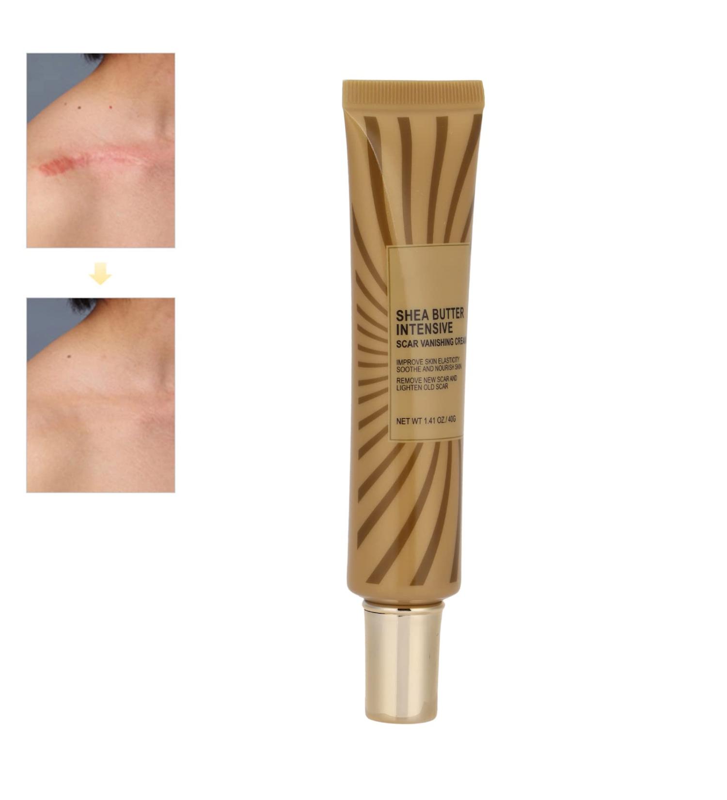 Scar Removal Cream 40g - Non-Oily Formula for Face & Body | Stretch Marks, Burns, & Scars Treatment - Buy Online on GoSupps.com