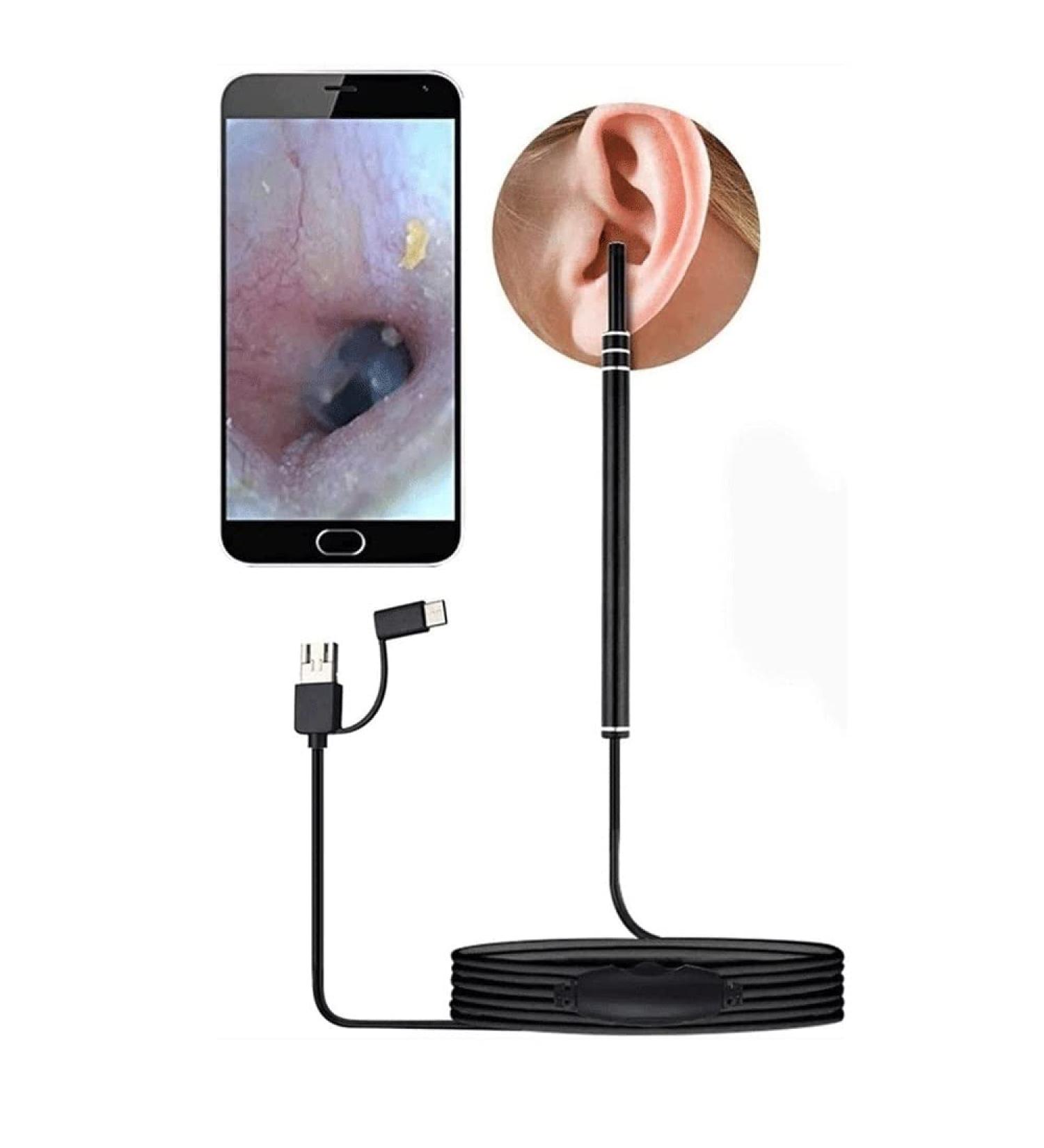 RMENST Ear Wax Removal Kit with HD Endoscope Camera - Earwax Removal Tool for Adults & Kids - Buy Online on GoSupps.com