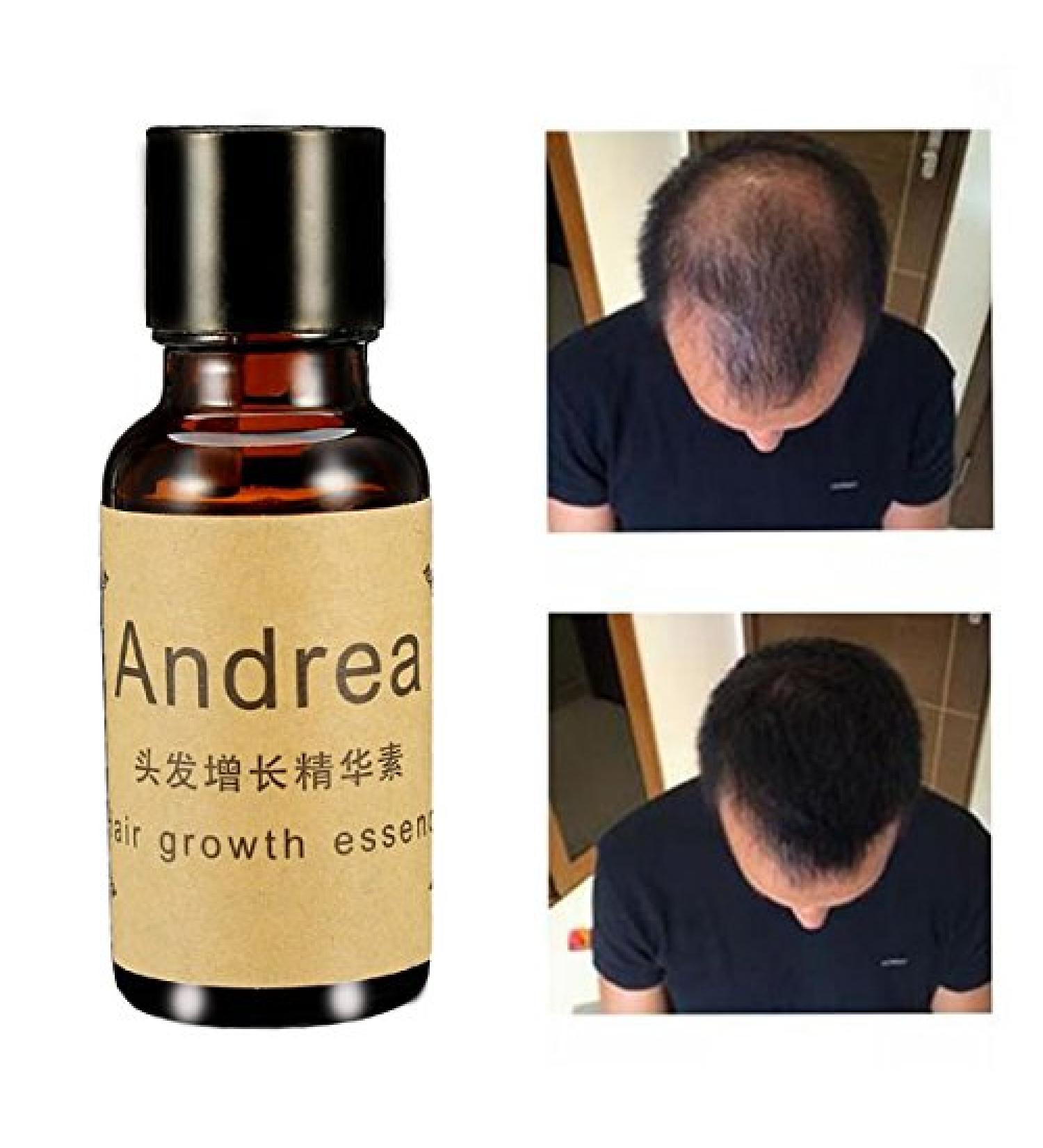 LM Fast Hair Growth Essence Liquid for Men & Women - 20ml | Boost Hair Growth & Thickness - Buy Online on GoSupps.com