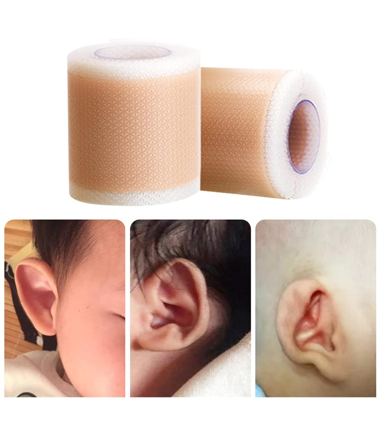 Surakey Silicone Newborn Baby Ear Correction Patch - Aesthetic Protruding Ear Sticker for Toddlers - Breathable Ear Patch 4x50CM - Shop Internationally - Buy Online on GoSupps.com