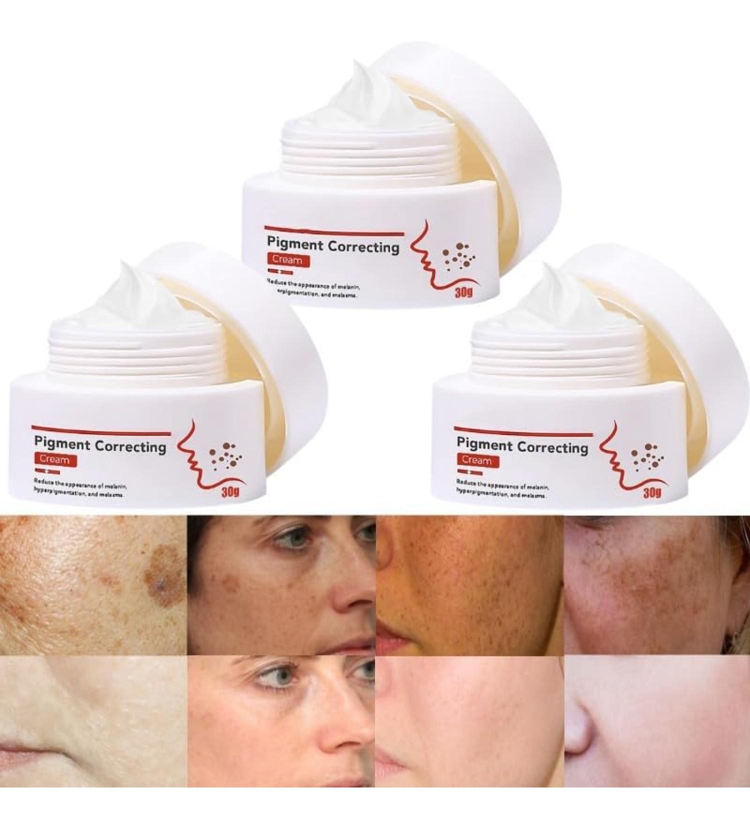 BEROZA 3Pcs Cremas Para Las Manchas de La Cara 30ml Crema Para Manchas Oscuras En La Cara Vitamin C&E Face Moisturizer Cream Crema para Manchas en La Cara - Buy Online on GoSupps.com