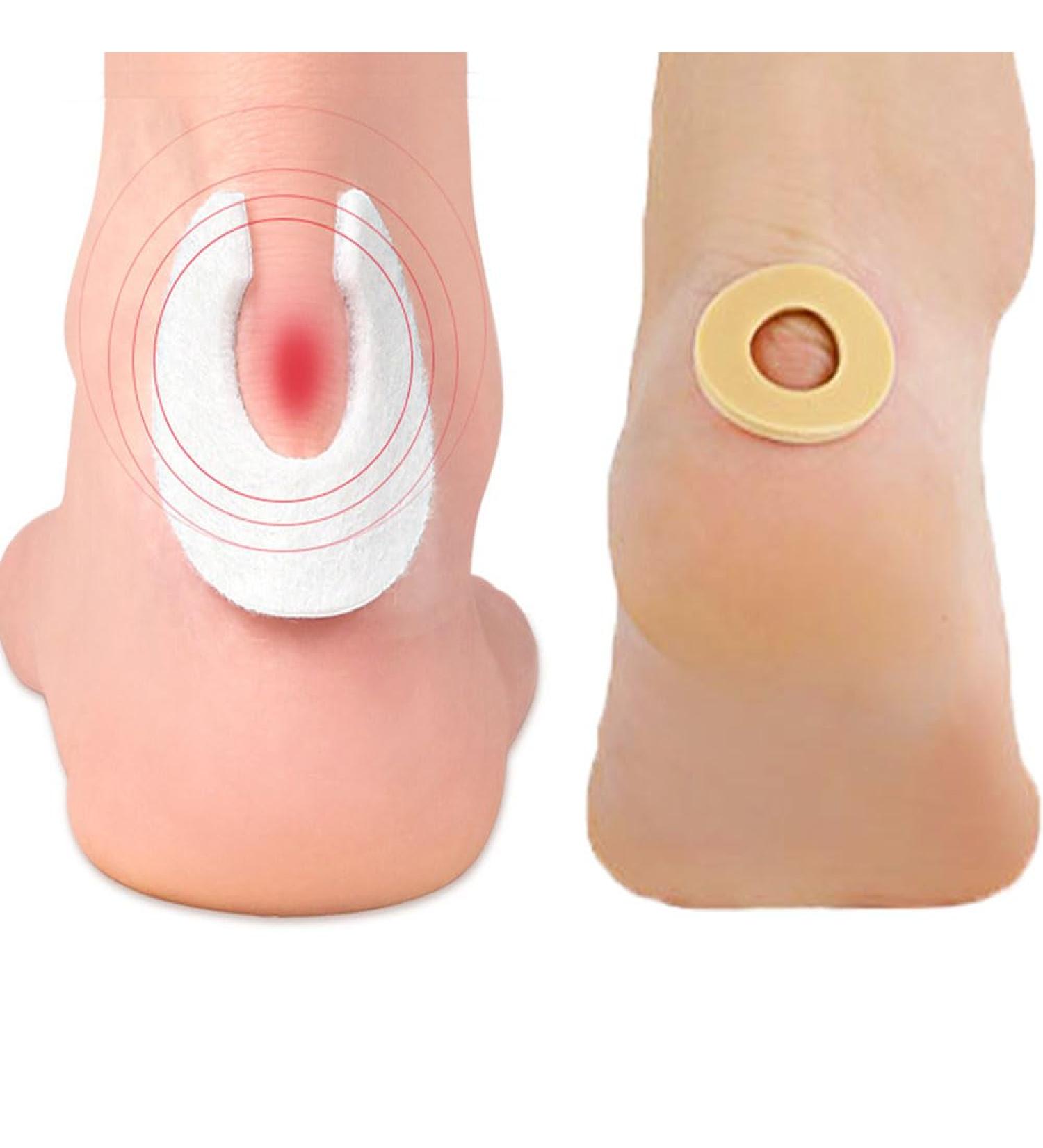 Felt Callus Pads & Foam Cushions Set - 6 Felt Pads & 45 Foam Toe Pads for Pain Relief & Protection | Comfortable Corn Cushions - International Shipping - Buy Online on GoSupps.com