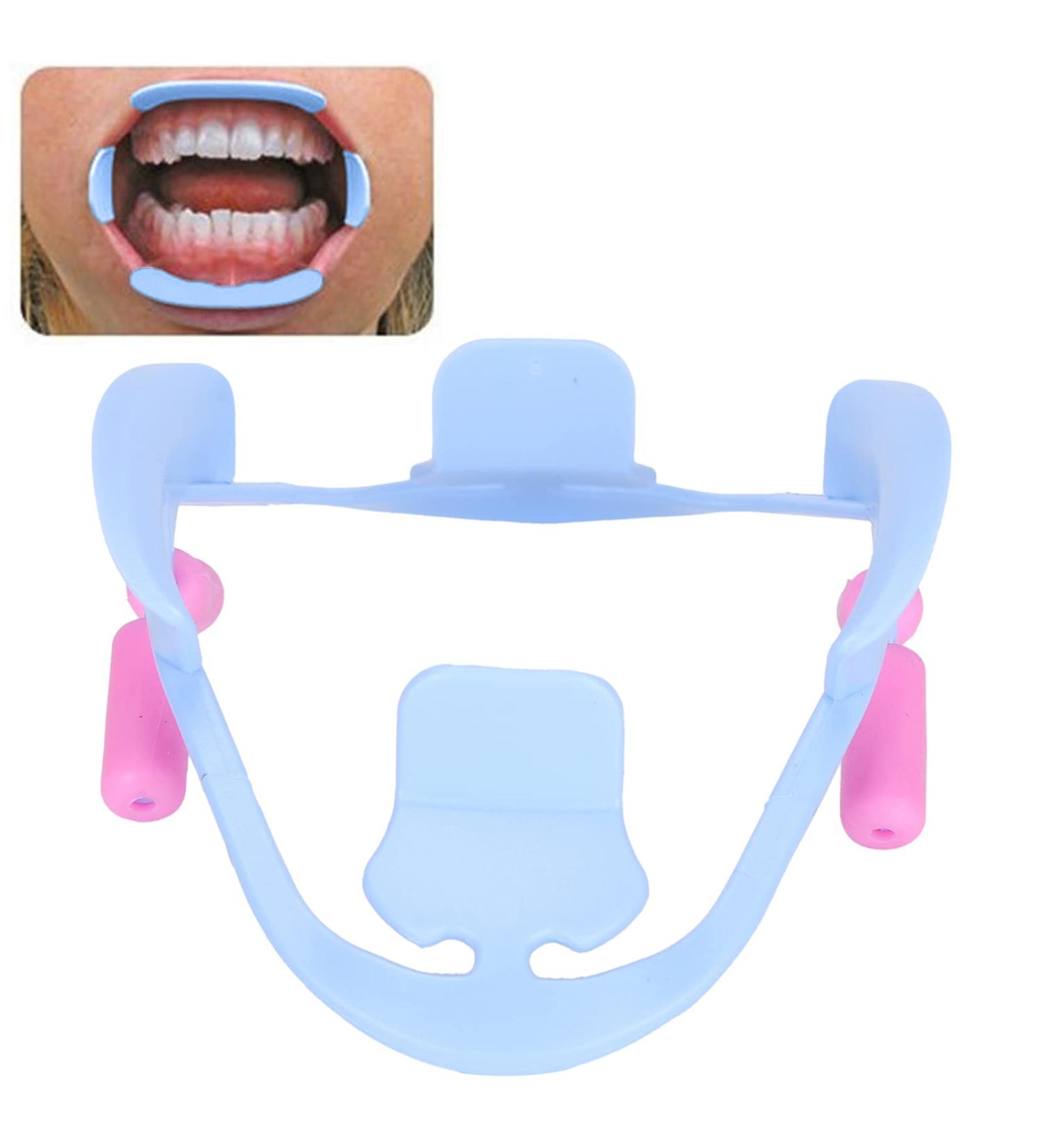 Buy Reusable 3D Oral Intraoral Cheeks Lips Retractor - Orthodontic Mouth Opener Accessories (Blue) | International Shipping - Buy Online on GoSupps.com