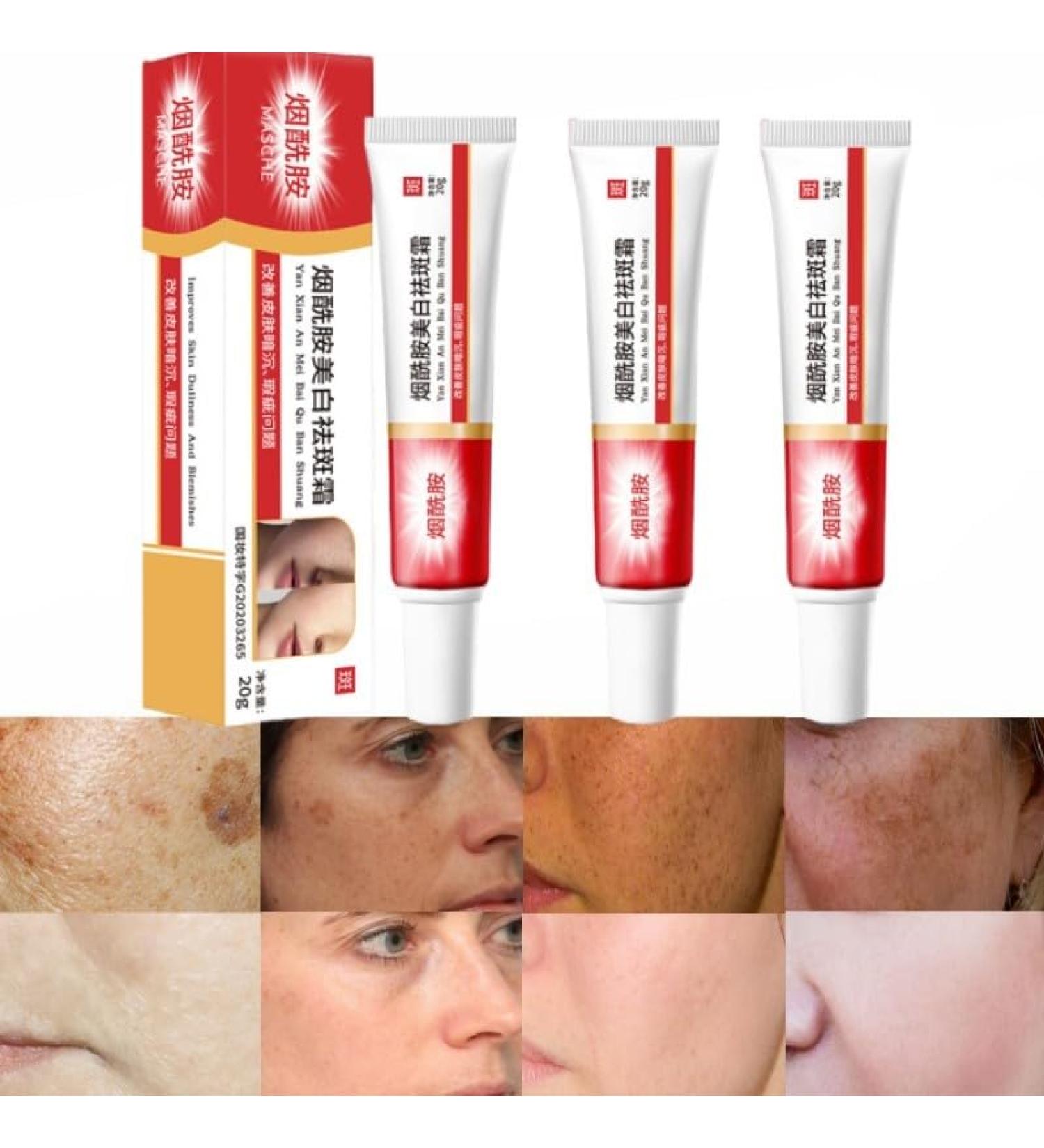 BEROZA 3PCS Crema Para Las Manchas De La Cara Cremas para Quitar Manchas de La Cara Face Moisturizer Cream Adecuado para varias reas como cara axilas cuello zona privade - Buy Online on GoSupps.com