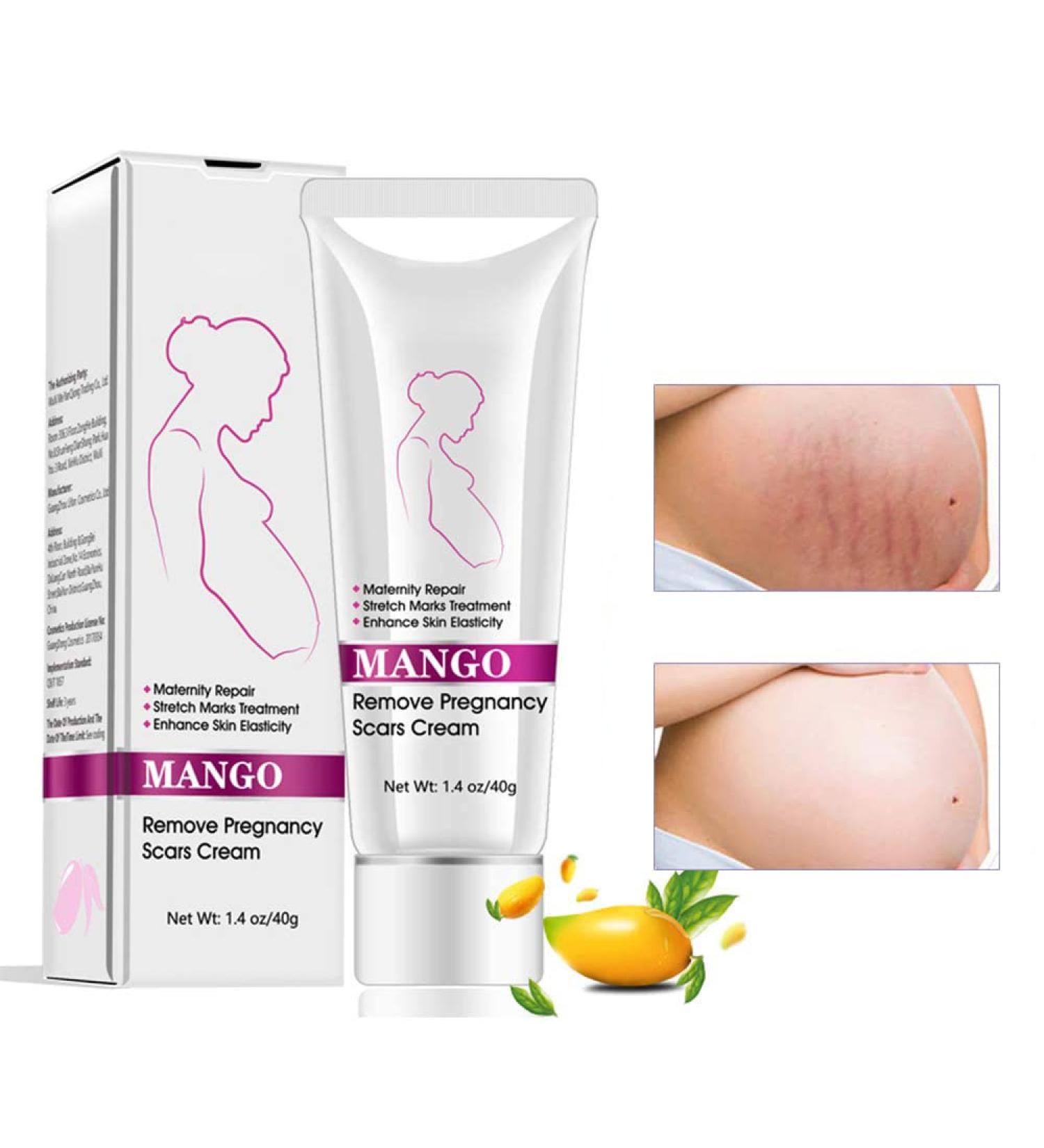 Stretch Marks & Scar Cream for Women | Body Repair Moisturizing Cream - 40g | Effective Post-Pregnancy Skin Care - Buy Online on GoSupps.com