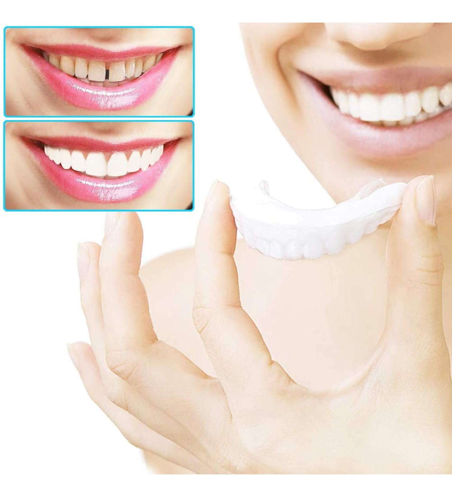 XLBHSH 4 Pairs Cosmetic Tooth Veneers Teeth Temporary Dentures Top and Bottom Instant Teeth Snap-on Cosmetic Dentures for Bad Teeth - Buy Online on GoSupps.com