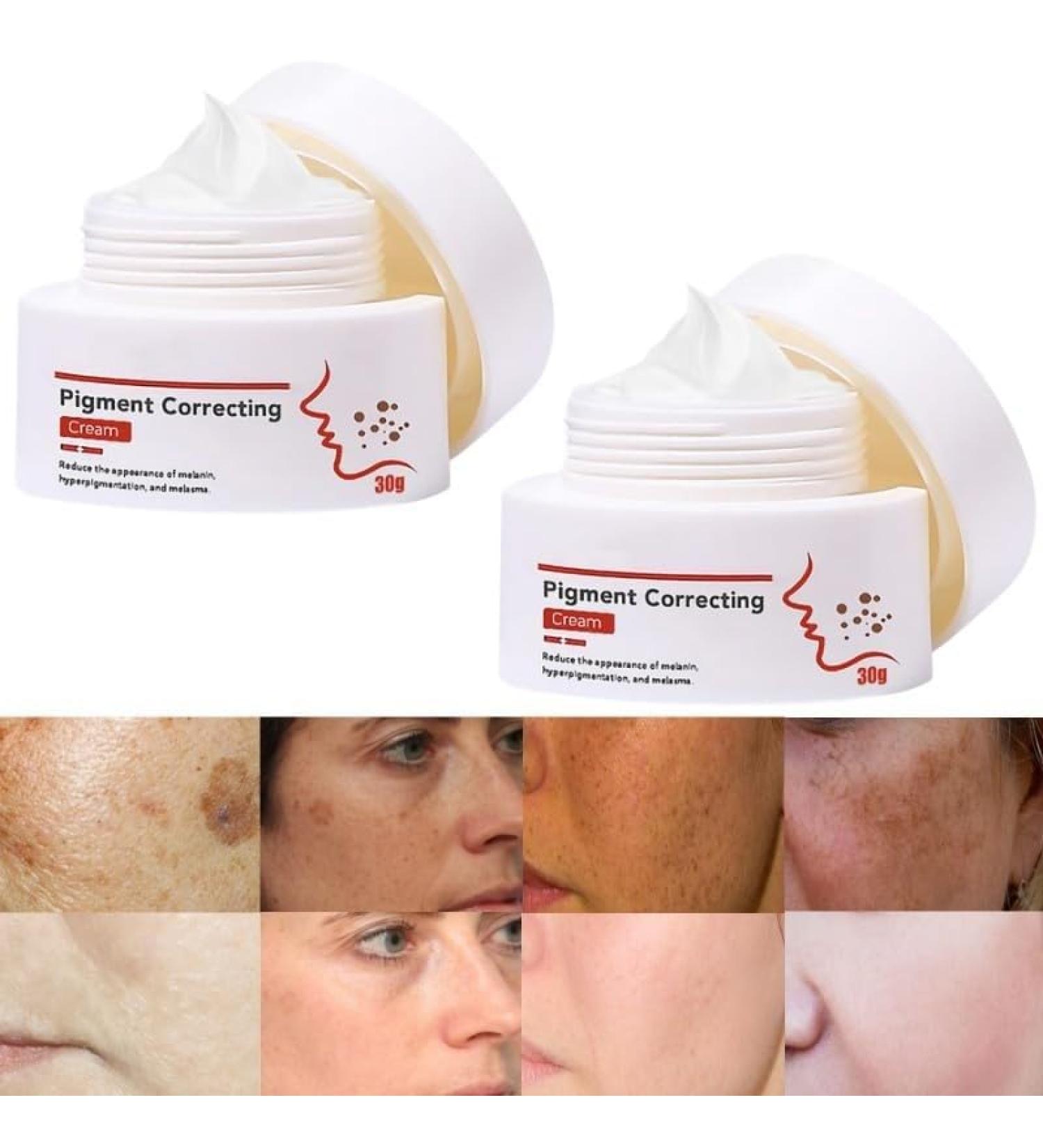 2Pcs Crema Para Manchas Oscuras En La Cara Cremas Para Las Manchas de La Cara Vitamin C&E Face Moisturizer Cream Crema Aclaradora Para Piel Manchas En Cara - Buy Online on GoSupps.com