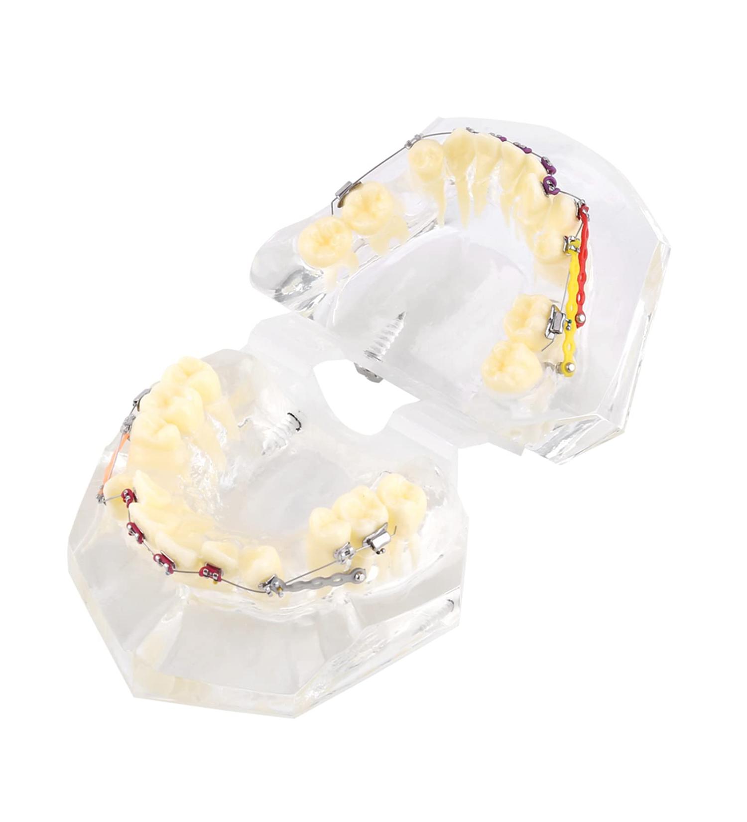 Orthodontic Treatment Weikeya Model | Harz Group PVC Teeth Learning - International Shipping Available - Buy Online on GoSupps.com