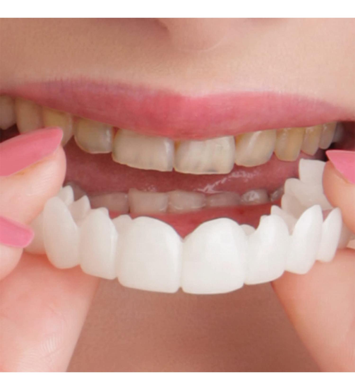 Brigtviee Dentures - 2 Pairs Upper & Lower Temporary Prostheses | Cosmetic Veneers & Tooth Whitening for Men & Women - Buy Online on GoSupps.com