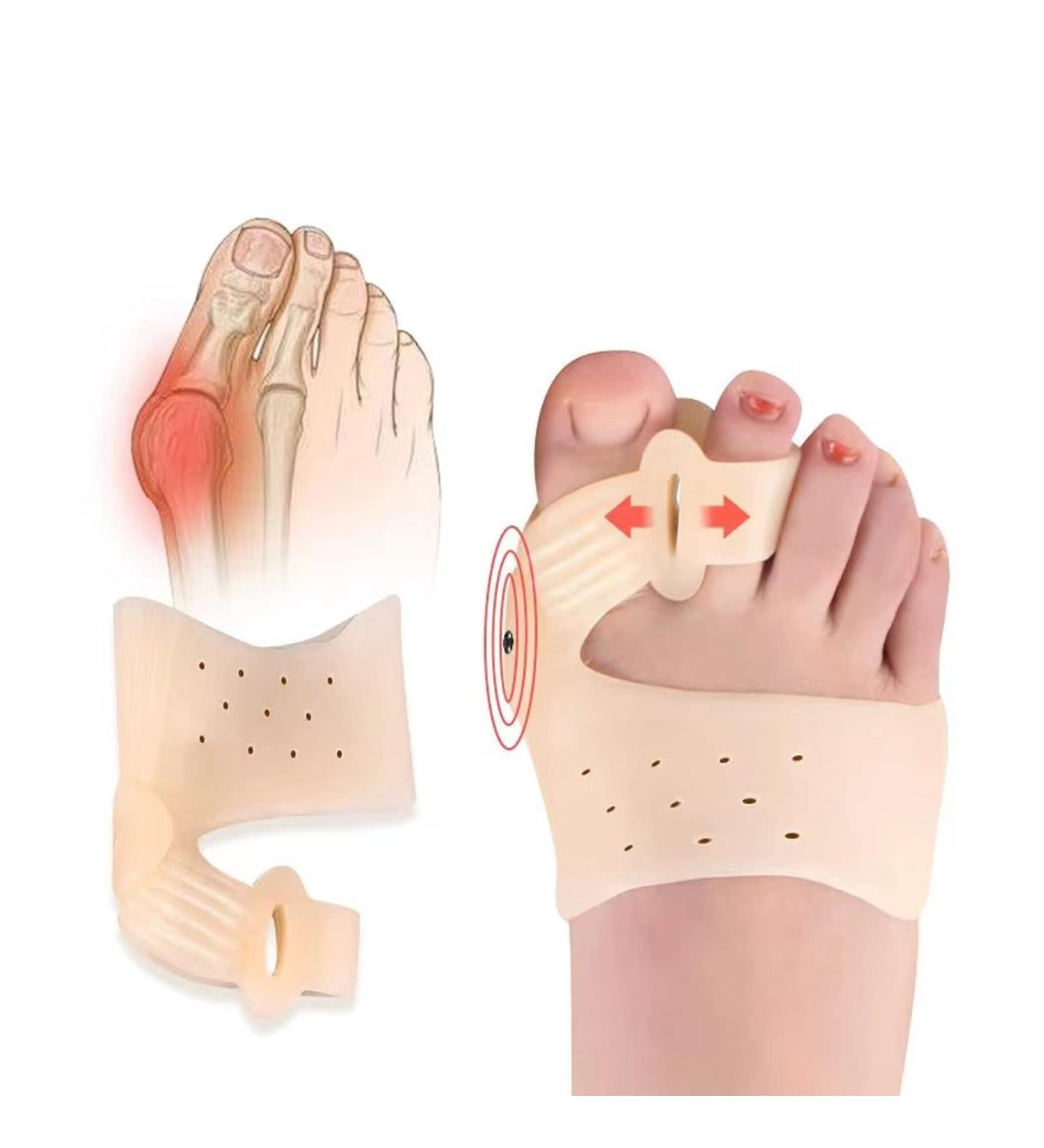 Shining Queen Bunion Corrector Toe Separator for Hallux Valgus & Big Toe Joint Pain Relief - 1 Pair Soft Gel Day/Night Support, Beige - Men & Women - Buy Online on GoSupps.com