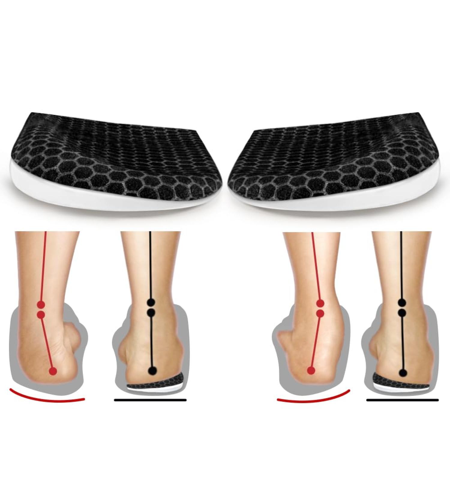 Corrective Insoles for Supination & Over-Pronation | Orthotic Heel Wedge Inserts for Foot Alignment | Relief from Bow Legs & Knee Pain - Sizes L Women 8-12/Men 7.5-13 - Buy Online on GoSupps.com