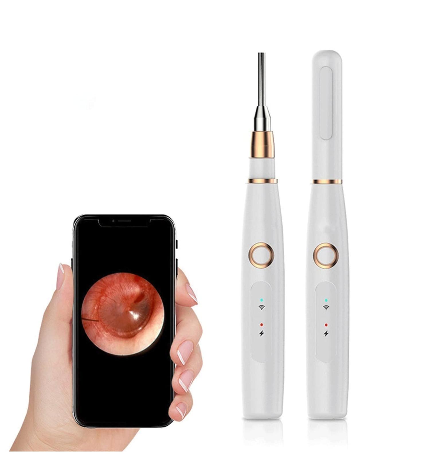 Marycan Ear Wax Removal Kit - High-Definition WiFi Otoscope with Smart Visual Ear Spoon | 3.9mm Ear Cleaner All-in-one Ear Wax Removal Tool - Buy Online on GoSupps.com