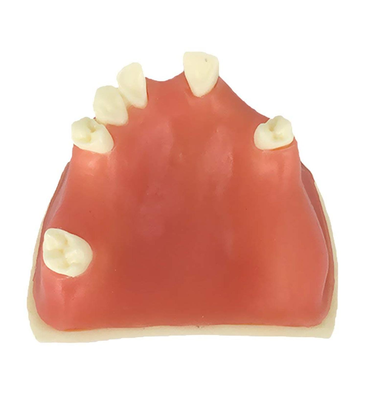 Samnuerly Education Model Toy - Upper Jaw Teeth Model for Sinus Lift & Implant Restoration (40mm) | Premium Dental Educational Tool - Buy Online on GoSupps.com