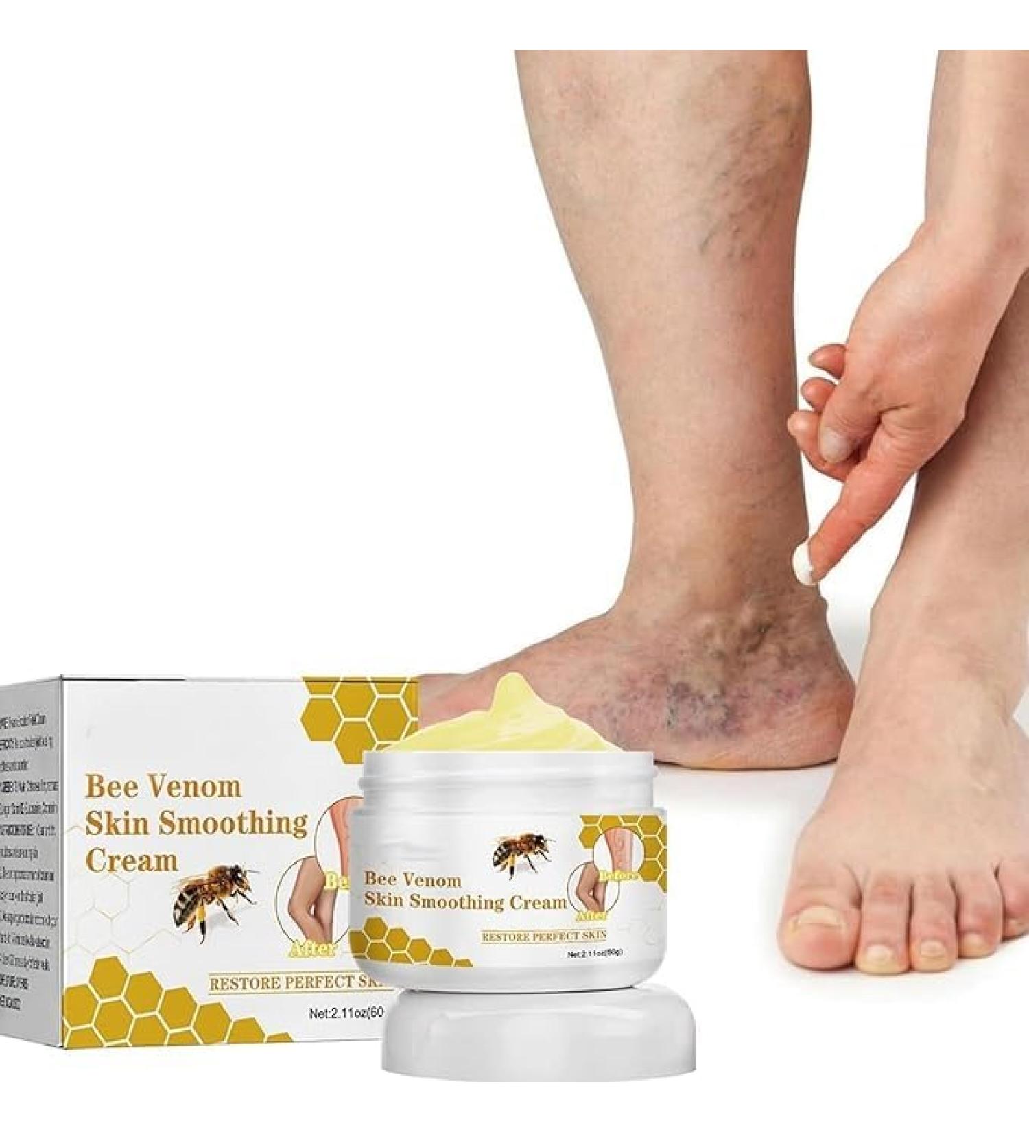 2024 New Bee Venom Varicose & Spider Veins Relief Cream for Legs Natural Varicose & Spider Veins Improve the Look of the Legs and Blood Circulation Tired and Heavy Legs Relief 60g/2.11fl.oz (1 Jars) - Buy Online on GoSupps.com