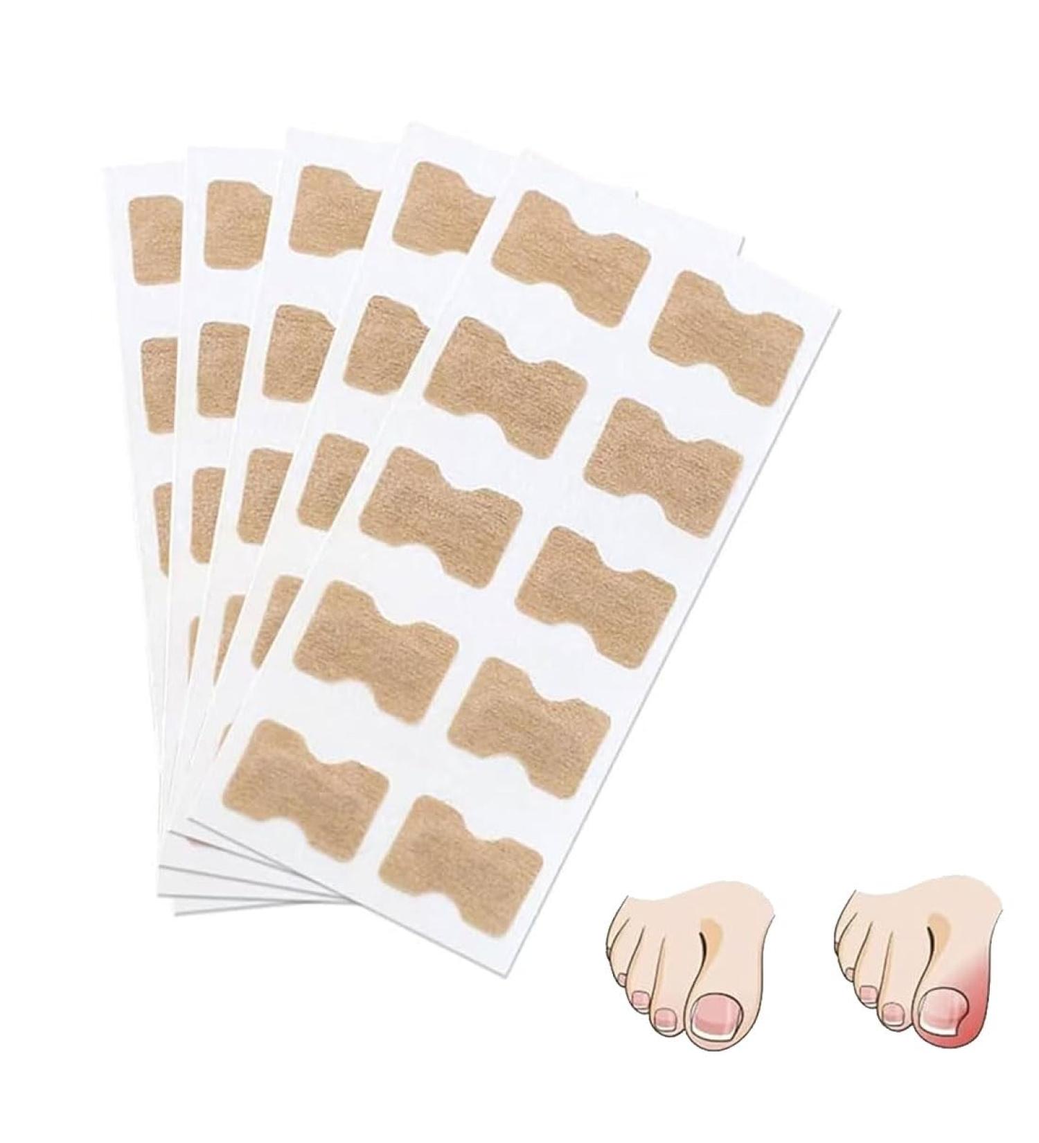 Nail Correction Stickers for Ingrown Toenails Relieve Pain Nail Treatment (50 count) - Buy Online on GoSupps.com