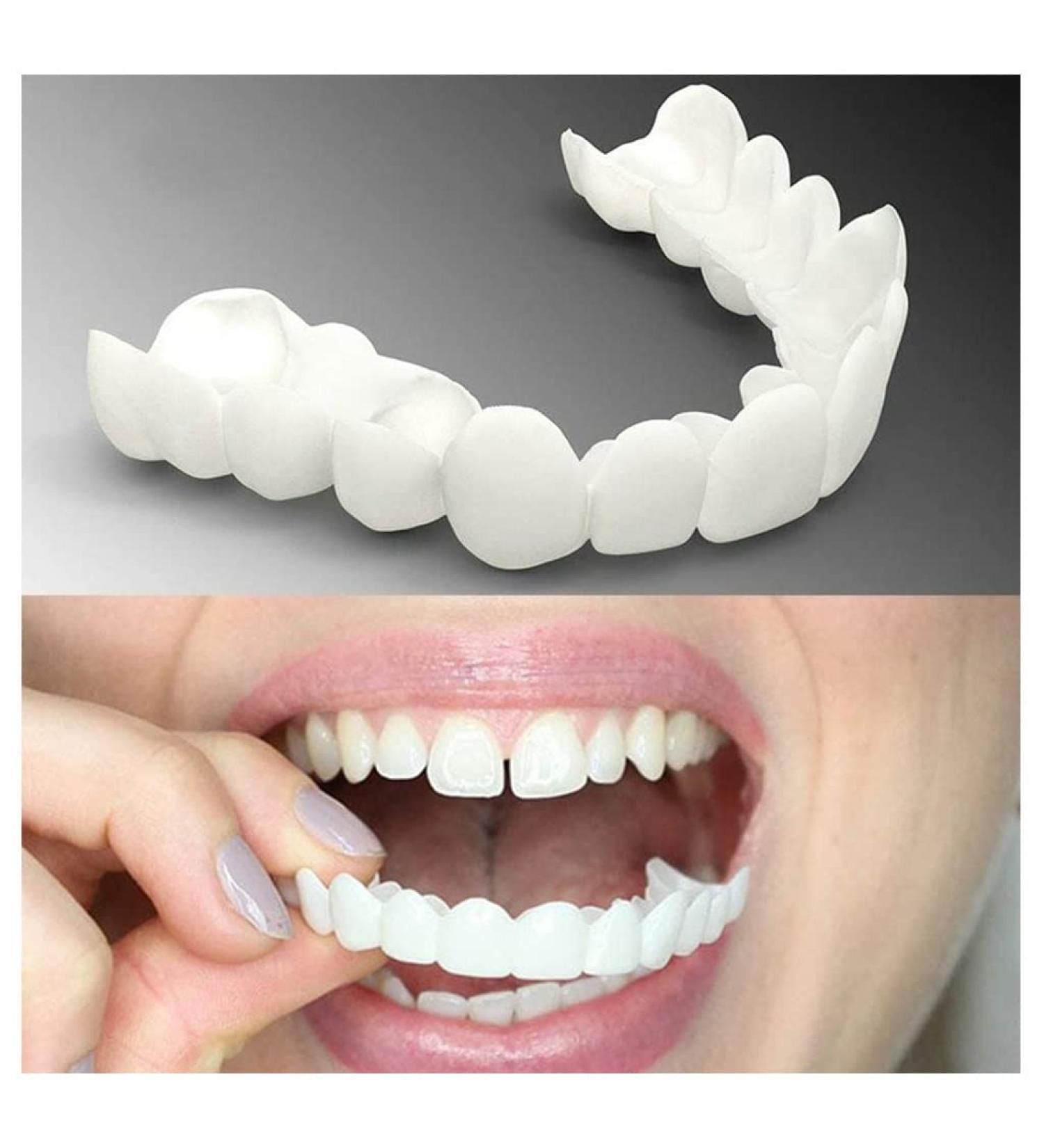 2 Pairs Cosmetic Teeth - Instant Snap-On Veneers for a Perfect Smile | White Teeth & Tidy Braces - International Shipping Available - Buy Online on GoSupps.com