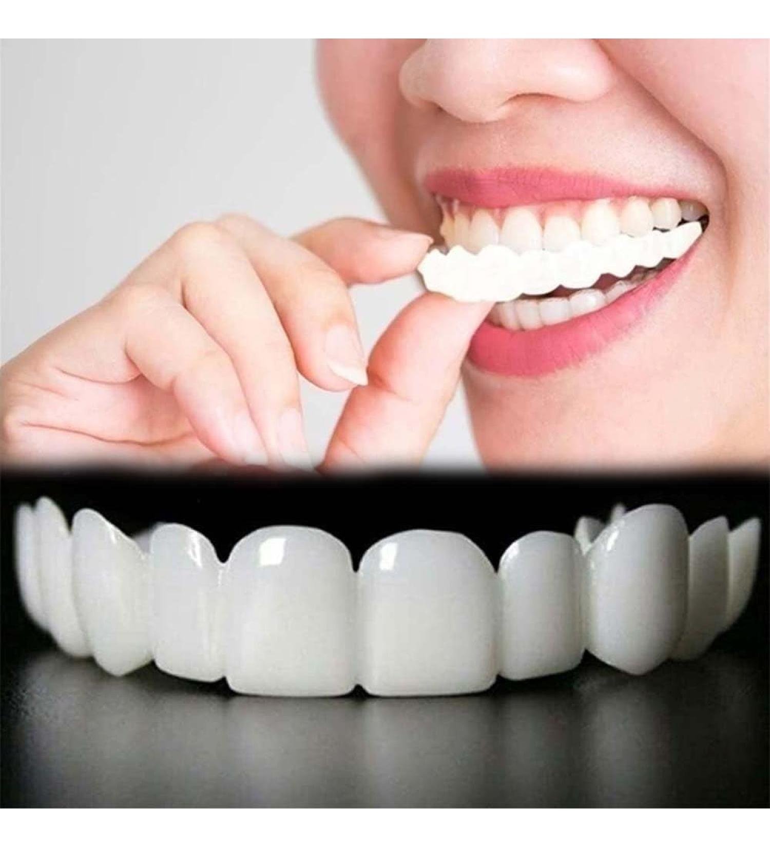 2 Pairs Natural Comfortable Design to Restore Confident Smile Temporarily Adjustable for Men and Women.(White) (3) - Buy Online on GoSupps.com