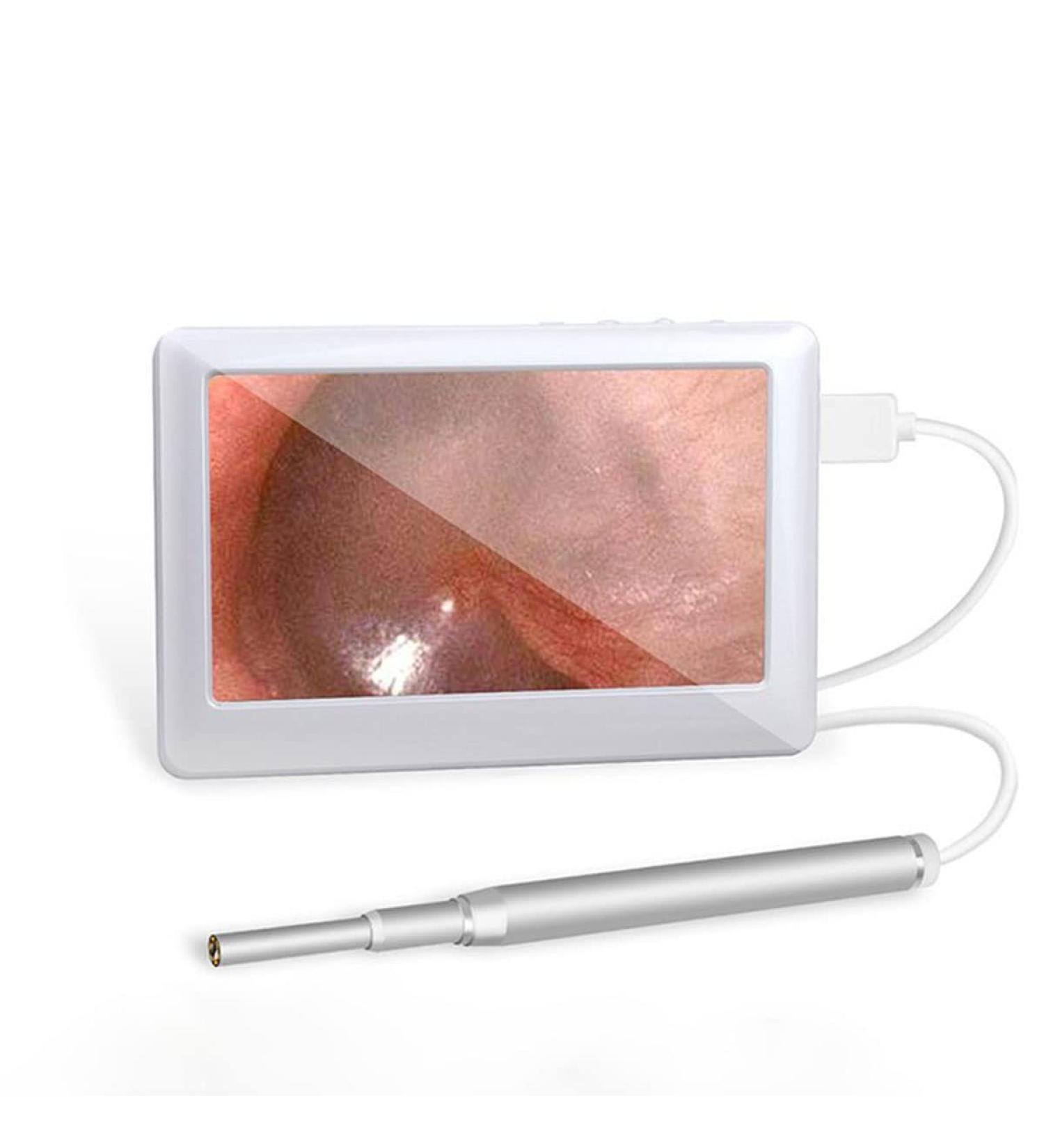 Feilx Ear Wax Removal Tool Ear Cleaner with Camera Endoscope Ear Pick 4.3 Inches Screen Earwax Removal Tools for Kids Adults - Buy Online on GoSupps.com