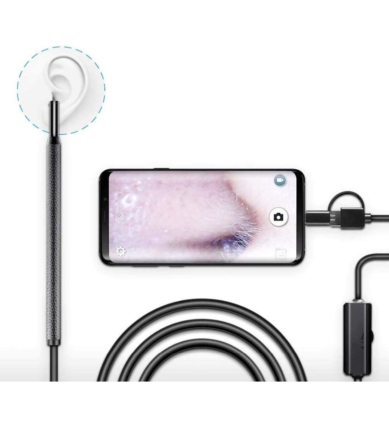 Eutuxia Ear Cleaning Endoscope with LED Light & Wax Removal Tool - Android iOS Tablet & Computer Compatible. Digital Otoscope Inspection Camera with Adjustable LEDs & Waterproof Cable - Buy Online on GoSupps.com