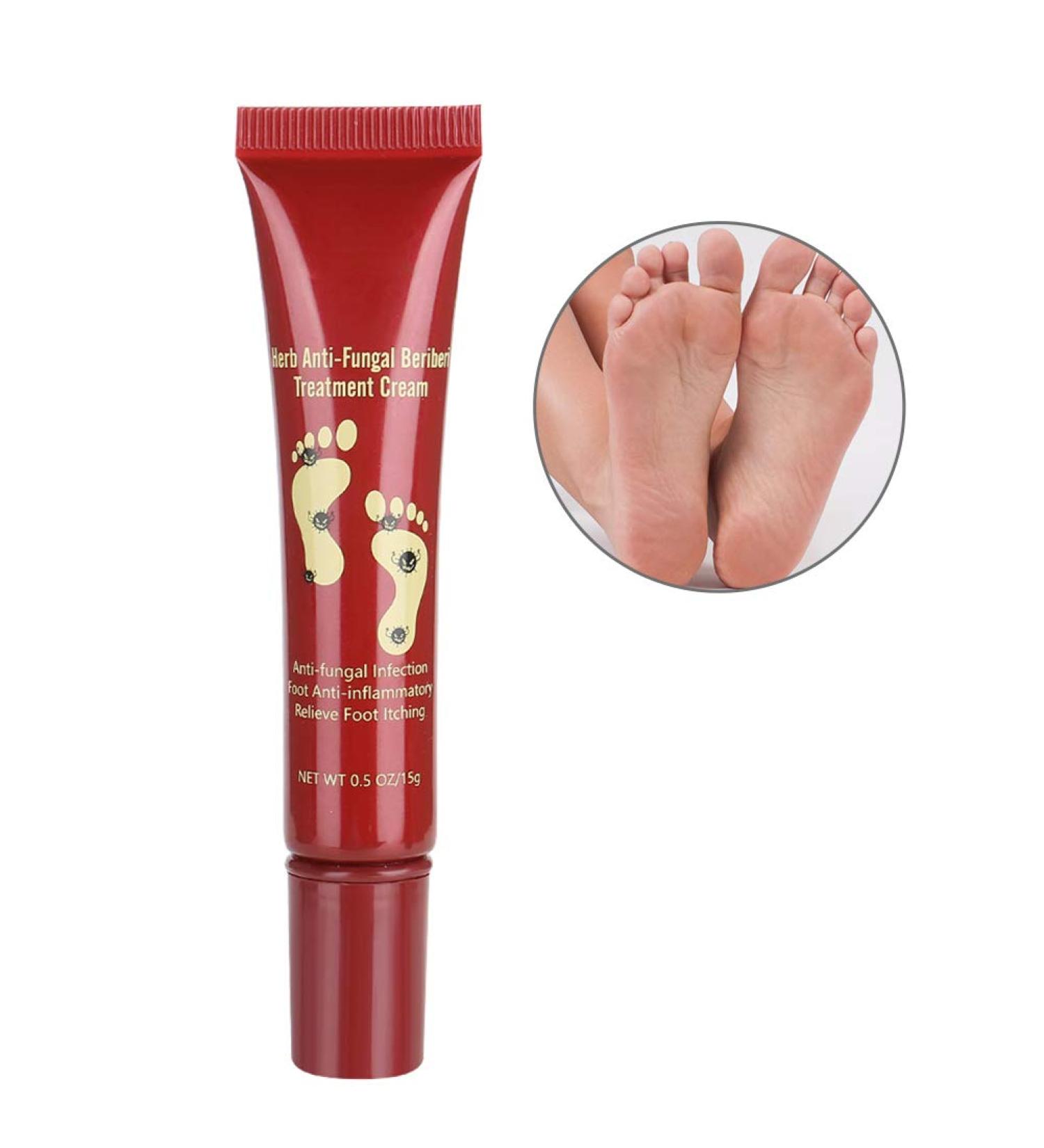 Crema para el Tratamiento de los Pies 15g | Hidratante Natural para Aliviar Hongos y Picaz n | Cuidado Efectivo para Plantas - Buy Online on GoSupps.com