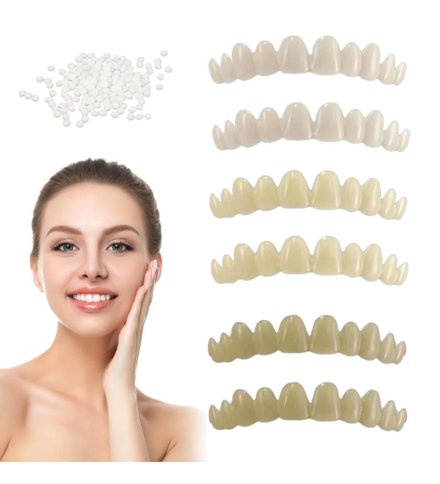 Temporary Tooth Repair Kit | Kraeoke Dentures & Tooth Filling - Easy Fast Solution for Missing Teeth - Buy Online on GoSupps.com