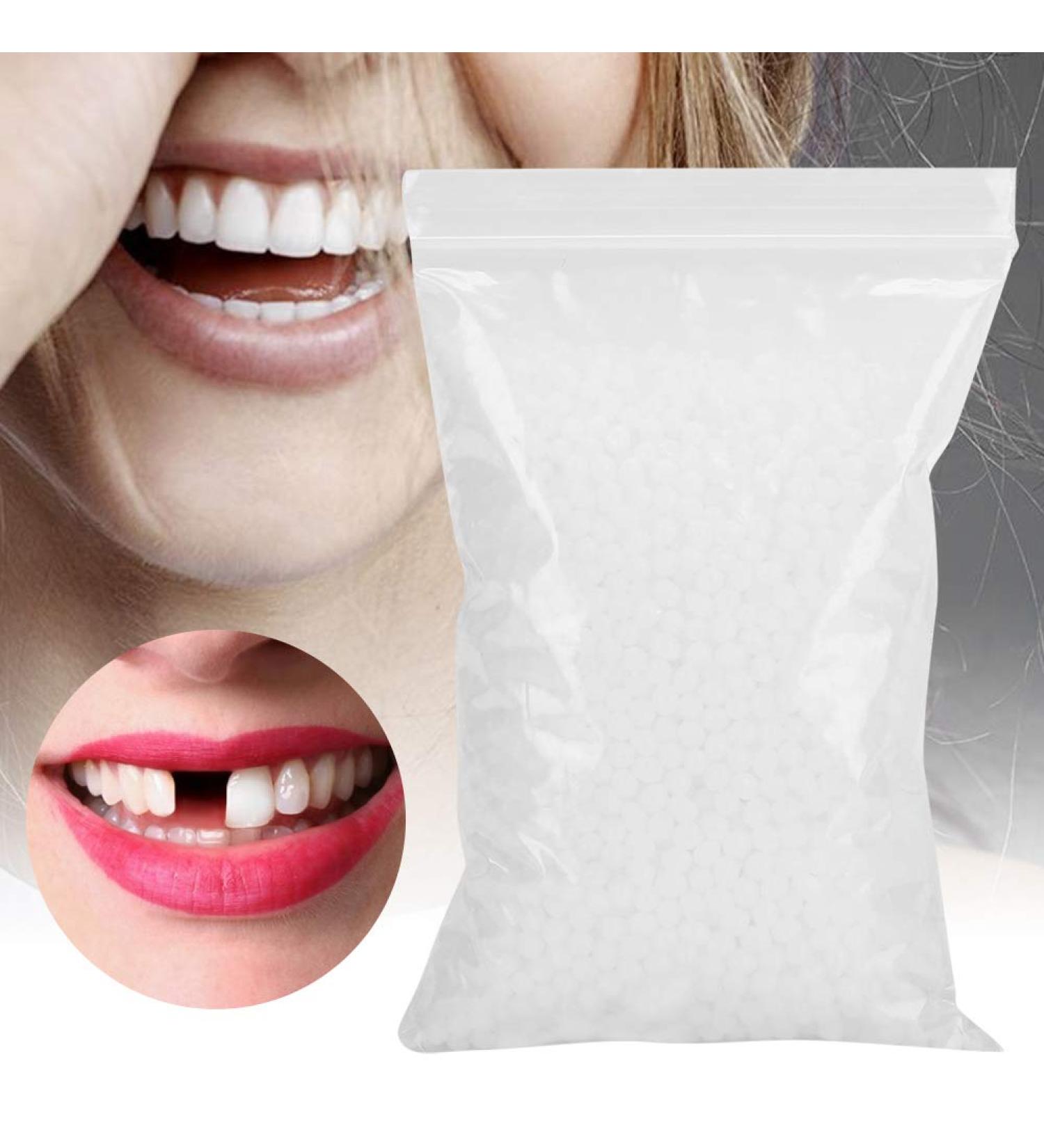 Multifunction Temporary Tooth Repair Bead 100g - Fix Broken Teeth - Buy Online on GoSupps.com
