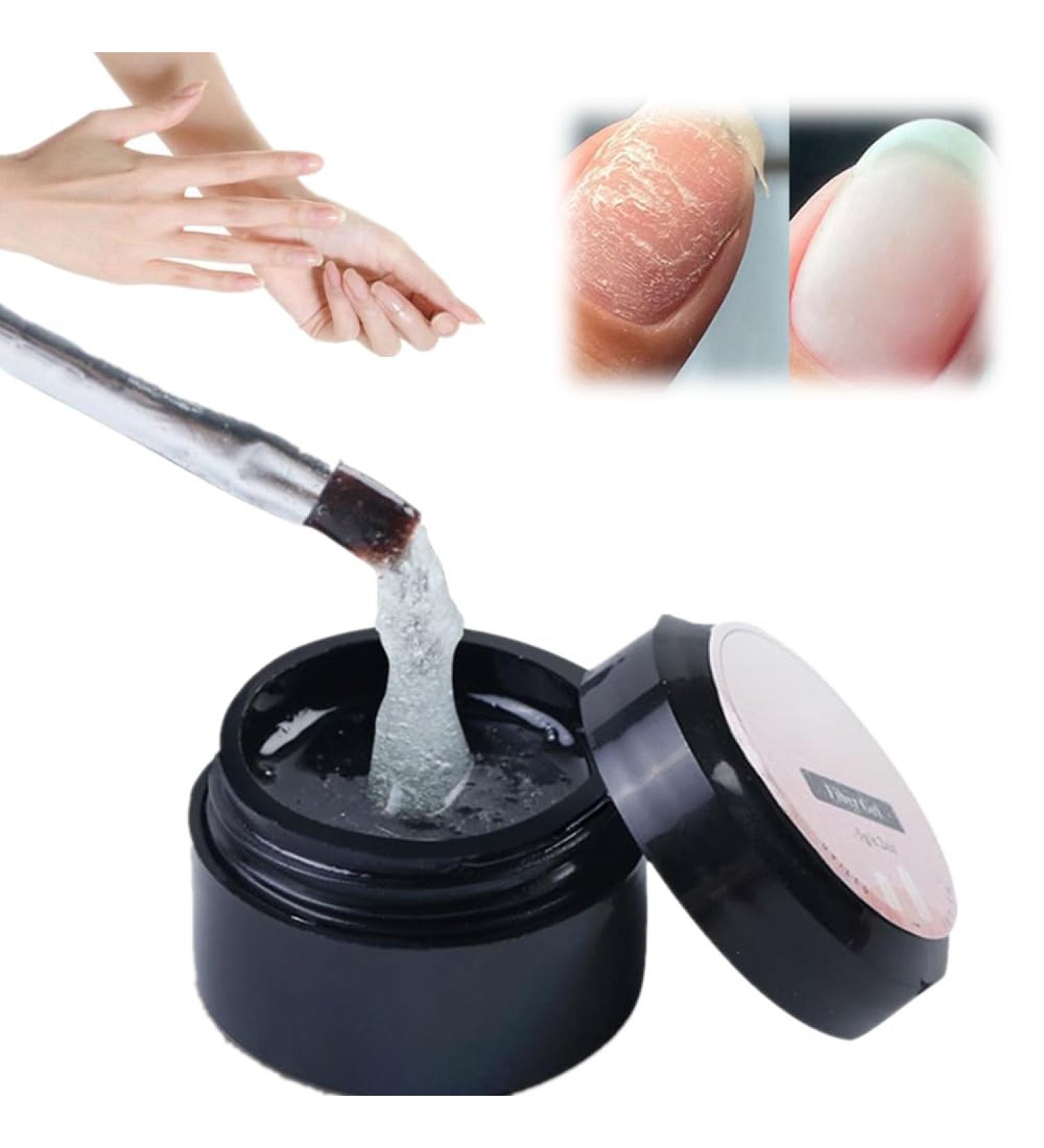  OLIREW 2Pcs Nail Repair Gel Protection Kit Split Natural Nail Repair Kit Broken Nail Repair Kit for Natural Nails - Buy Online on GoSupps.com