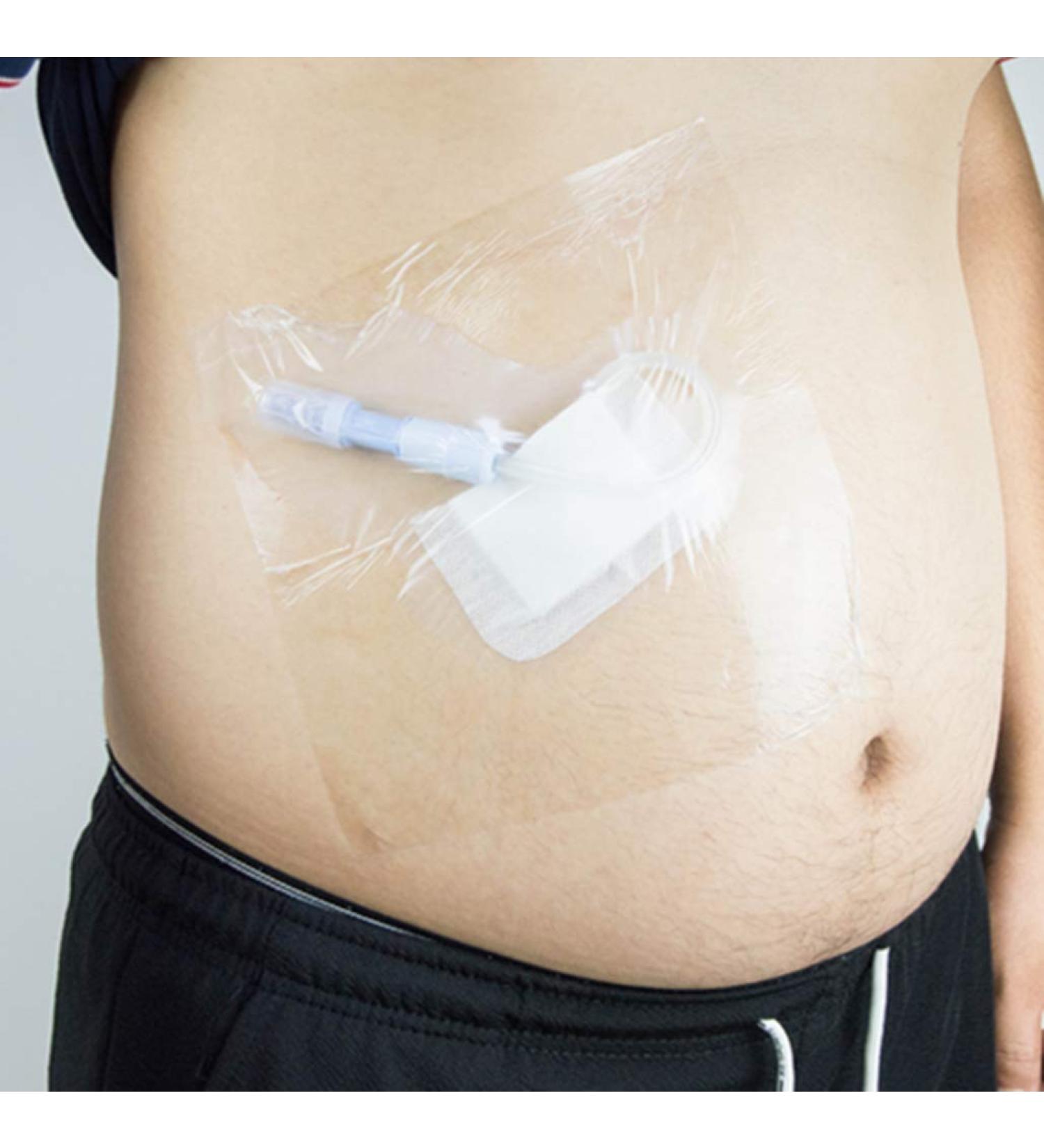 Shower Shield 8 x 8 PICC Line Cover - Moisture Barrier Wound Dressing (7 Pack) - Buy Online on GoSupps.com